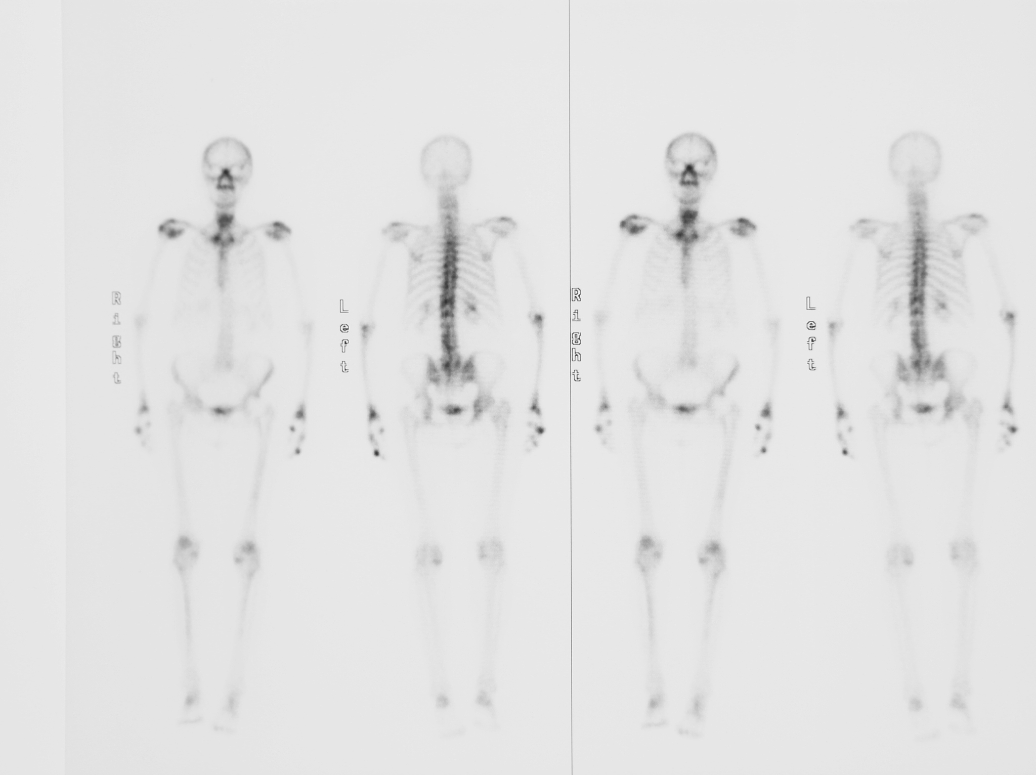 生化危机病毒种类大全 - 详解游戏中的致命病毒
