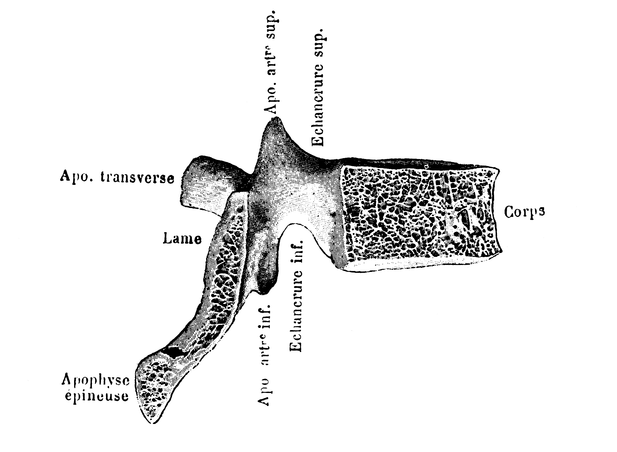 对于多孔介质中裂喉收缩和膨胀