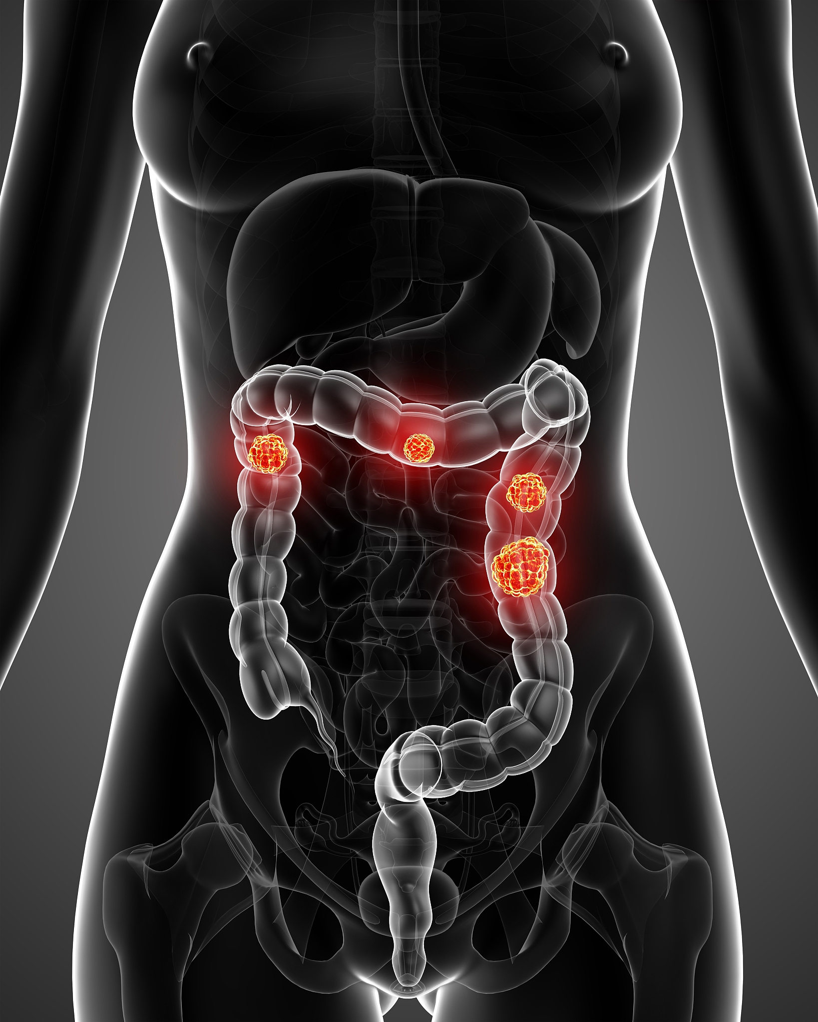 肚脐眼周围轻微疼痛怎么办？常见原因及处理方法