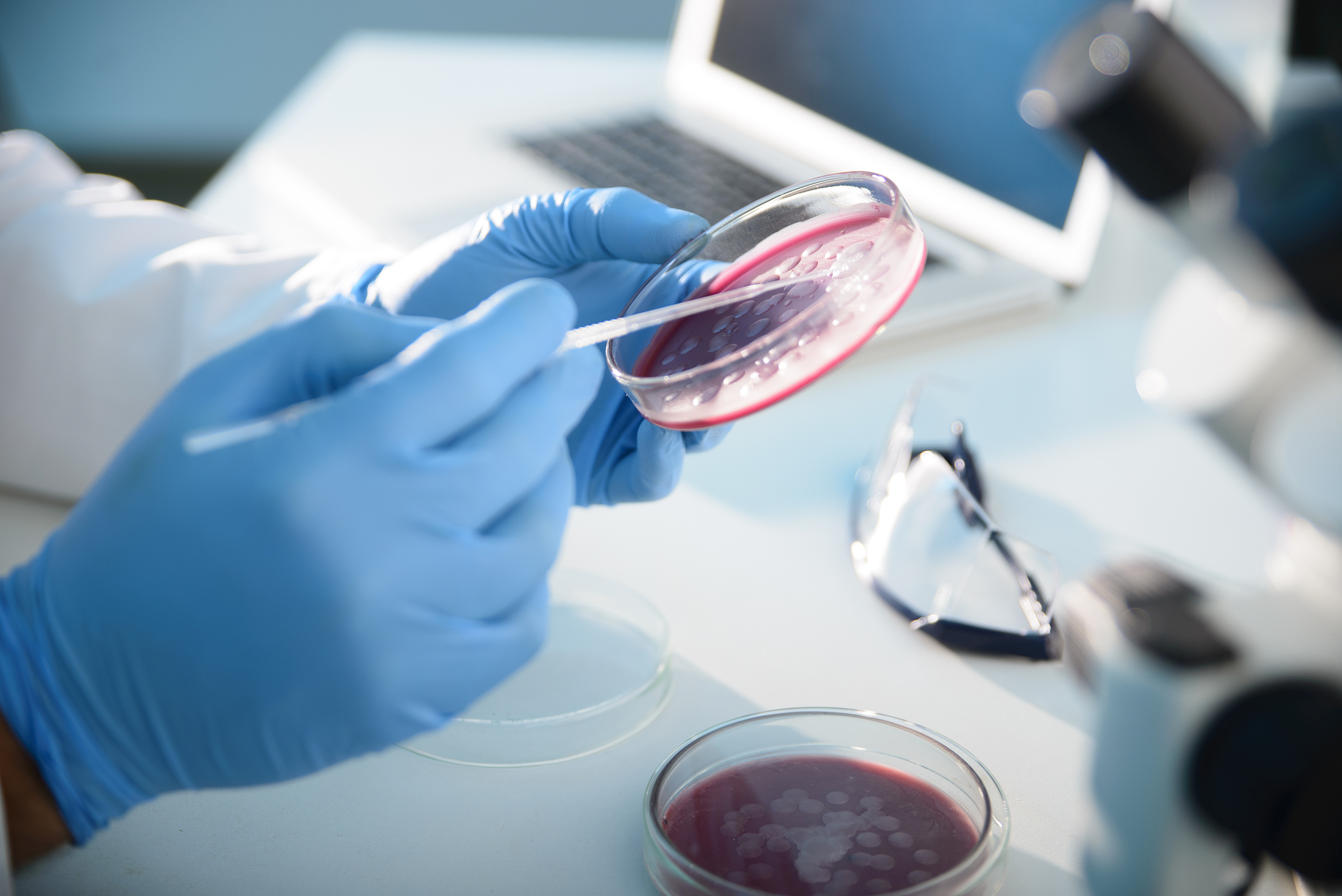 microbiological culture