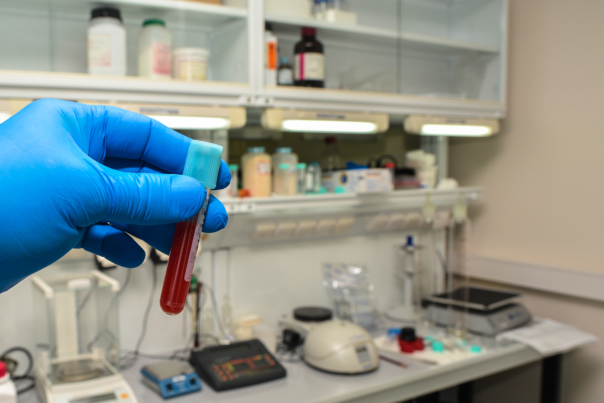 细胞冻存指南：完整步骤及注意事项 - 保持细胞活力