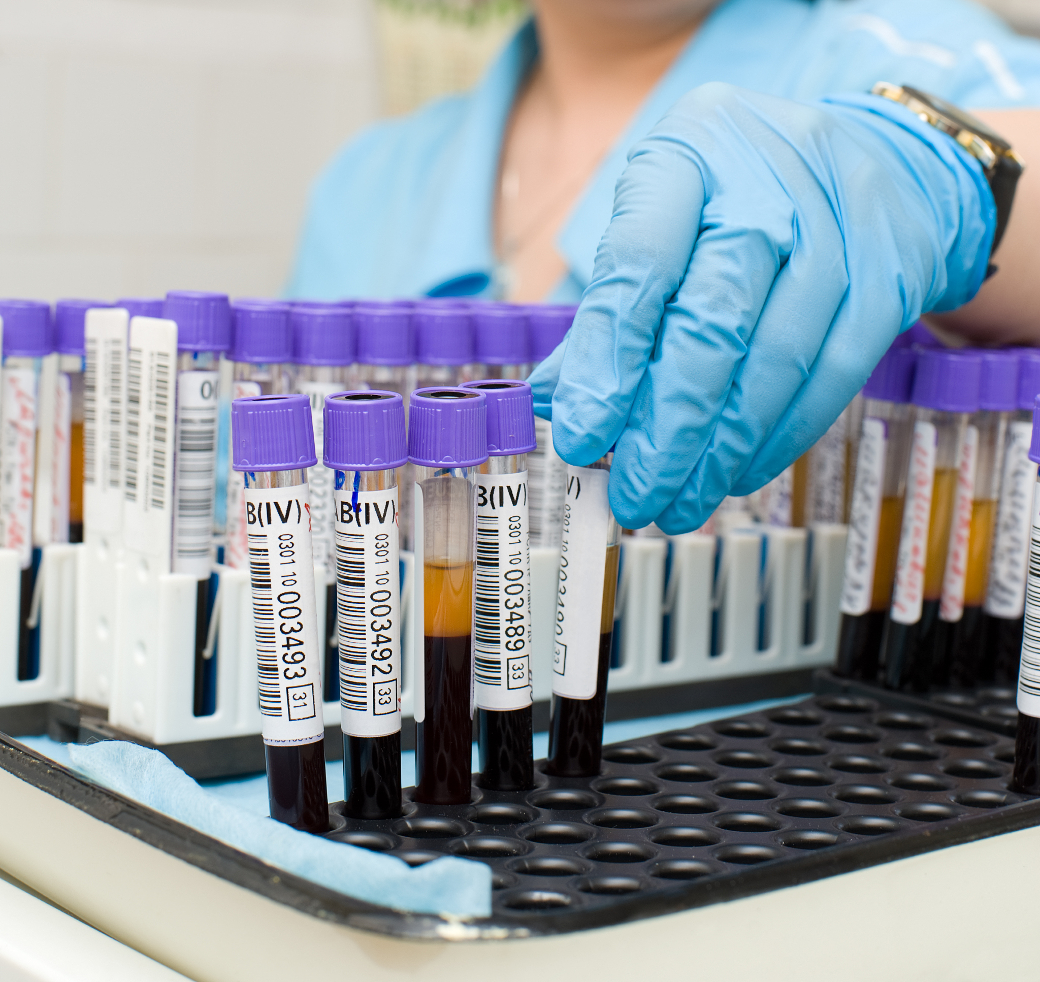 抗体获得策略：免疫接种、单克隆抗体、体外选择等