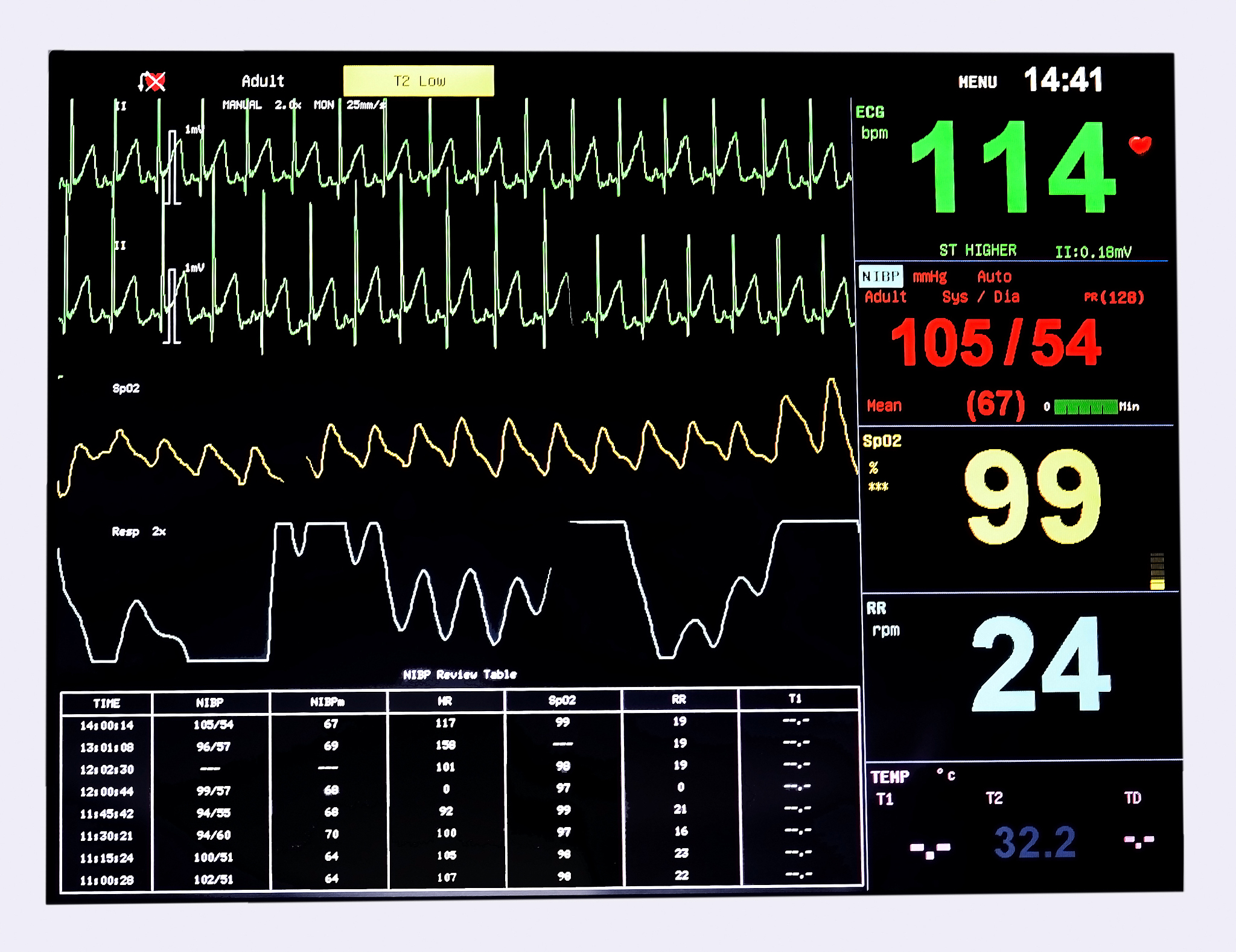如何识别三相电的相序