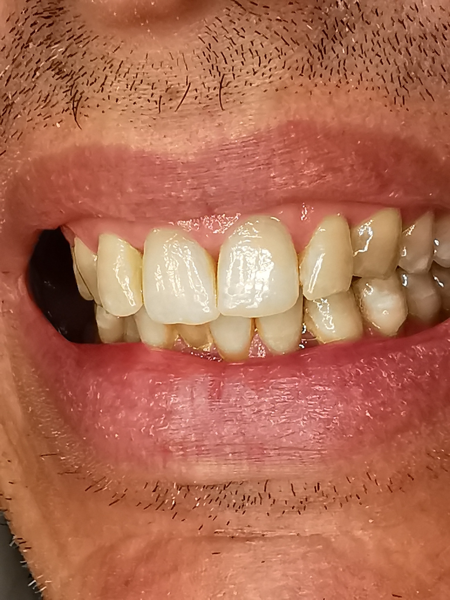 高中毕业学口腔医学专业怎么样？