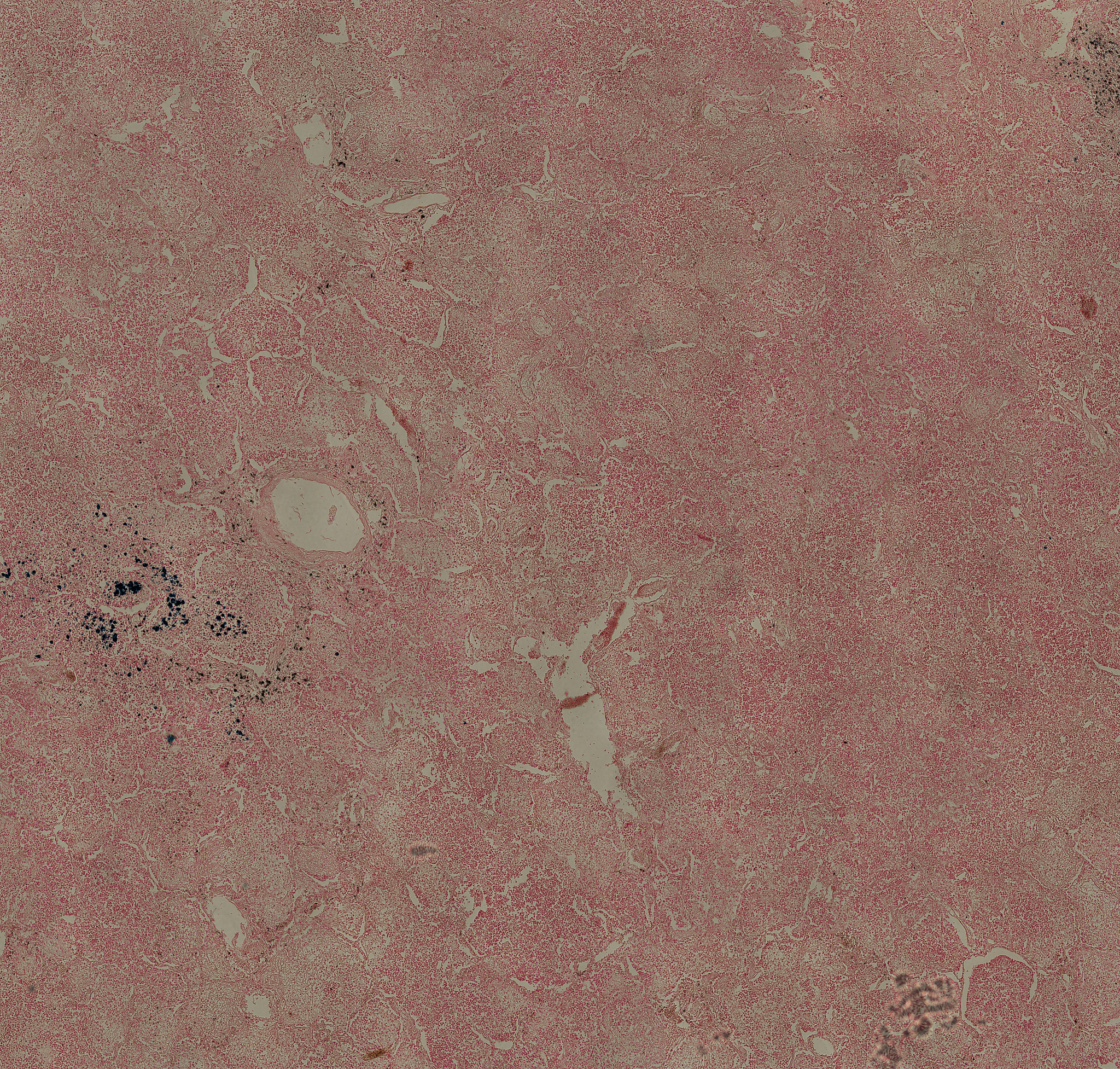 脂蛋白信号肽与脂锚定蛋白：什么是脂锚定蛋白？