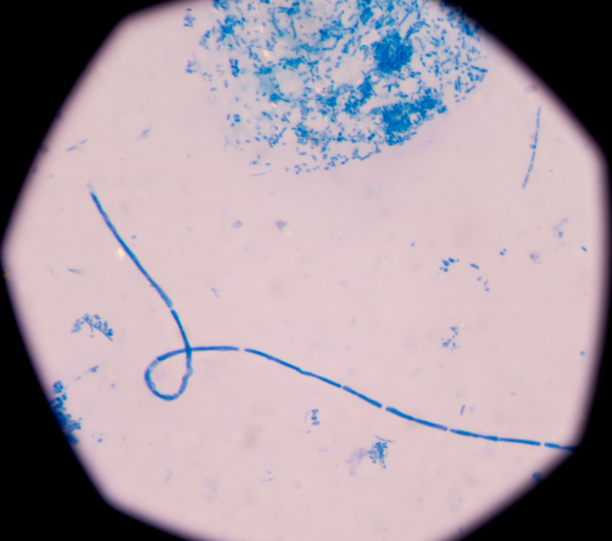 诺卡氏放线菌的菌丝类型