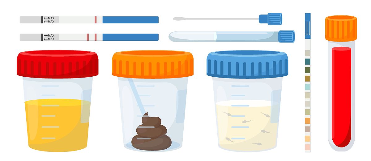 孕前检查有哪些生成文章