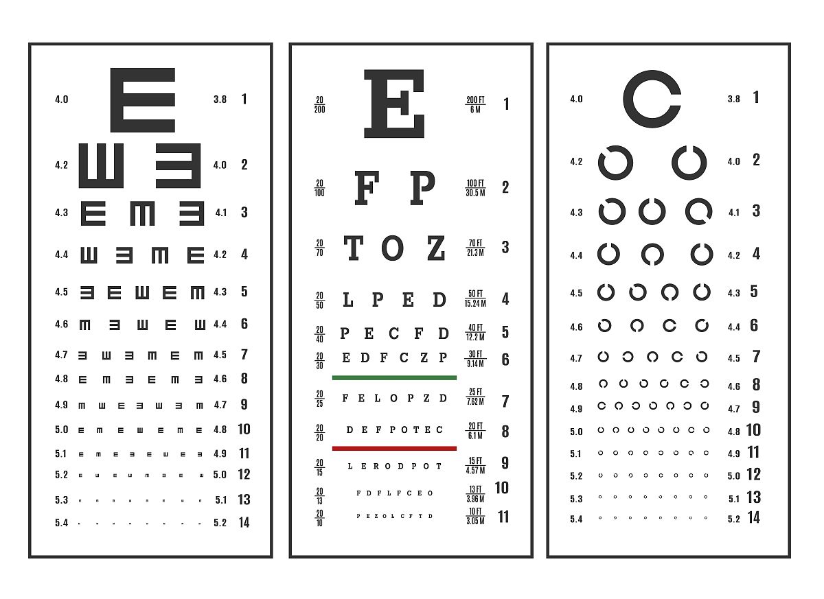 写视觉功能训练对斜弱视儿童视力的影响至少2000字中文