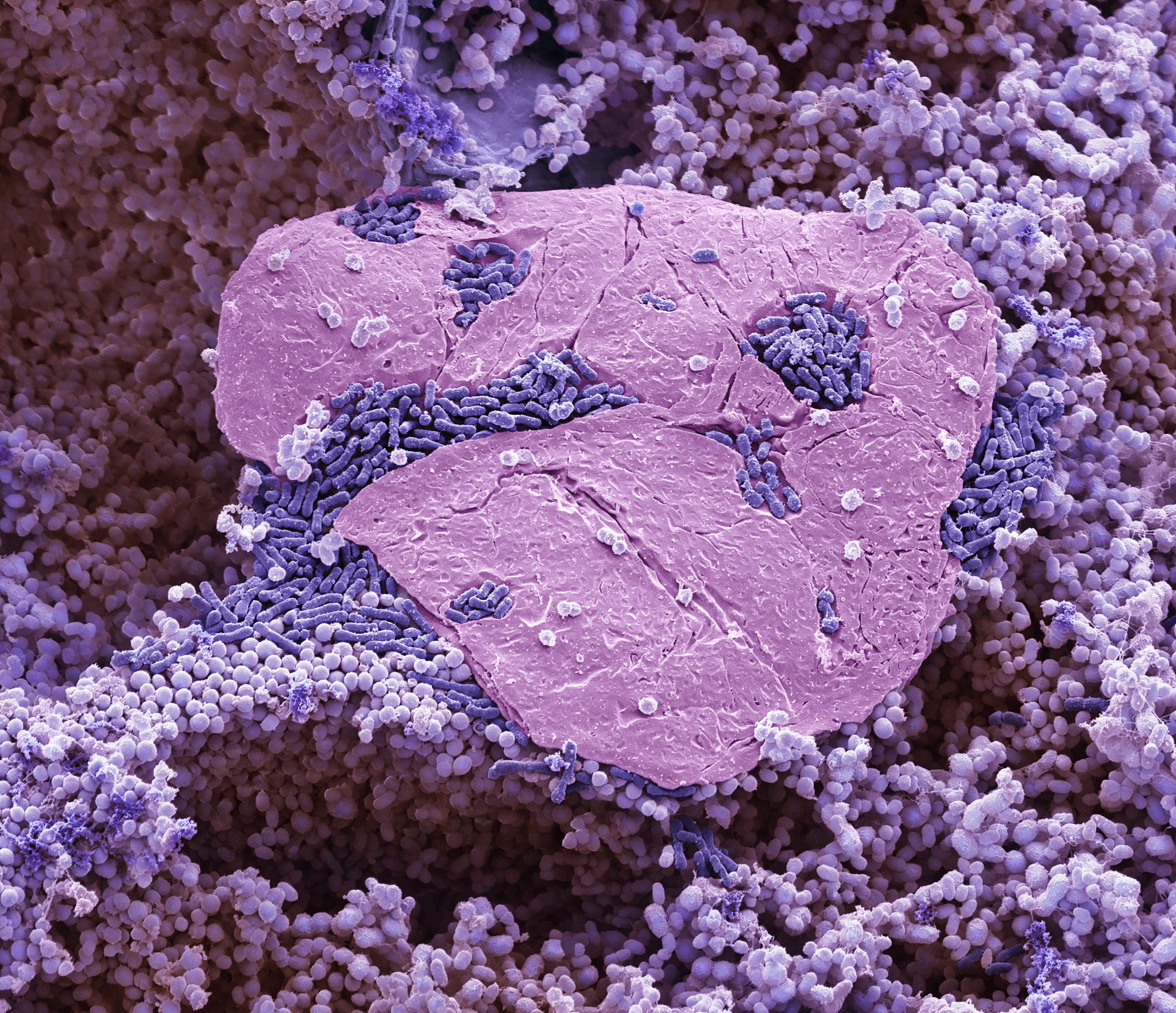 Comparative Plastome Analysis of Phlegmariurus Reveals Stable IR Regions and Distinct Species Differentiation