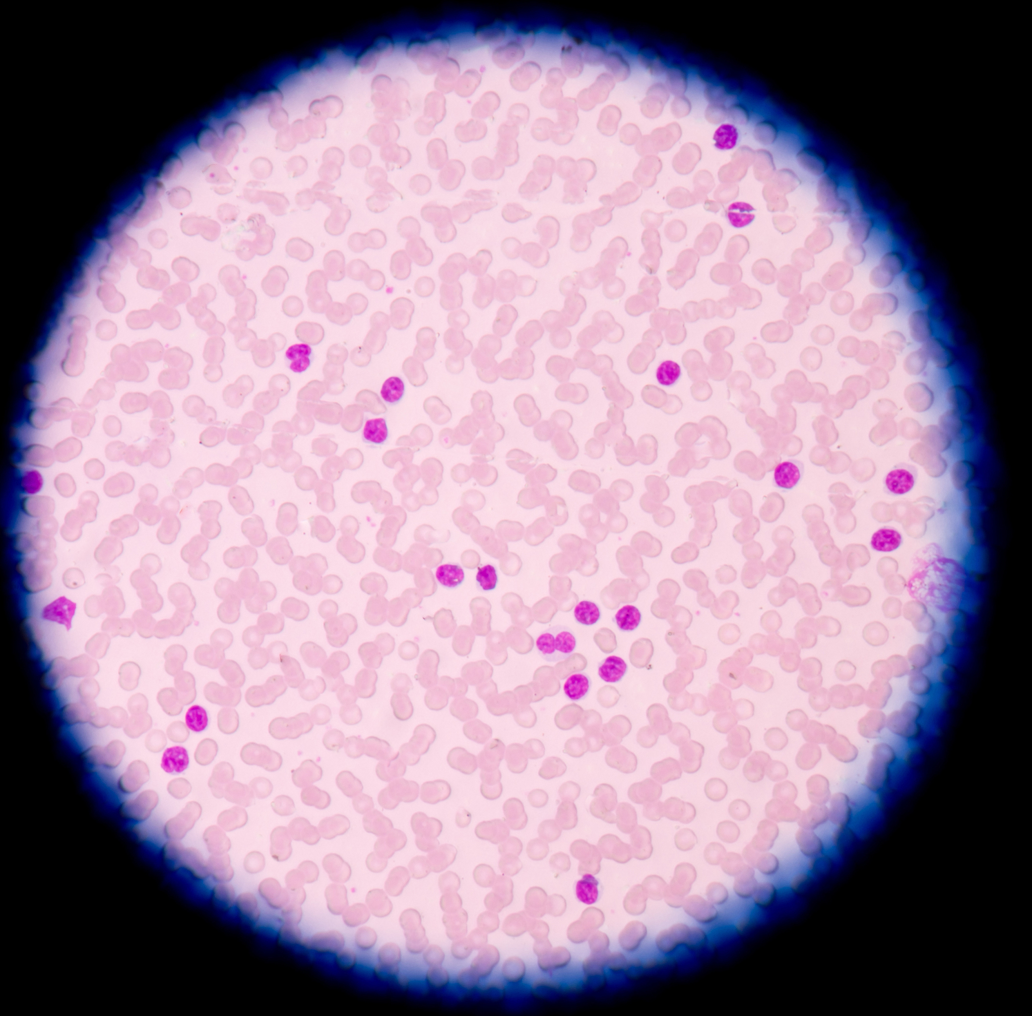 WBC 白细胞计数 1313 109L 35-95