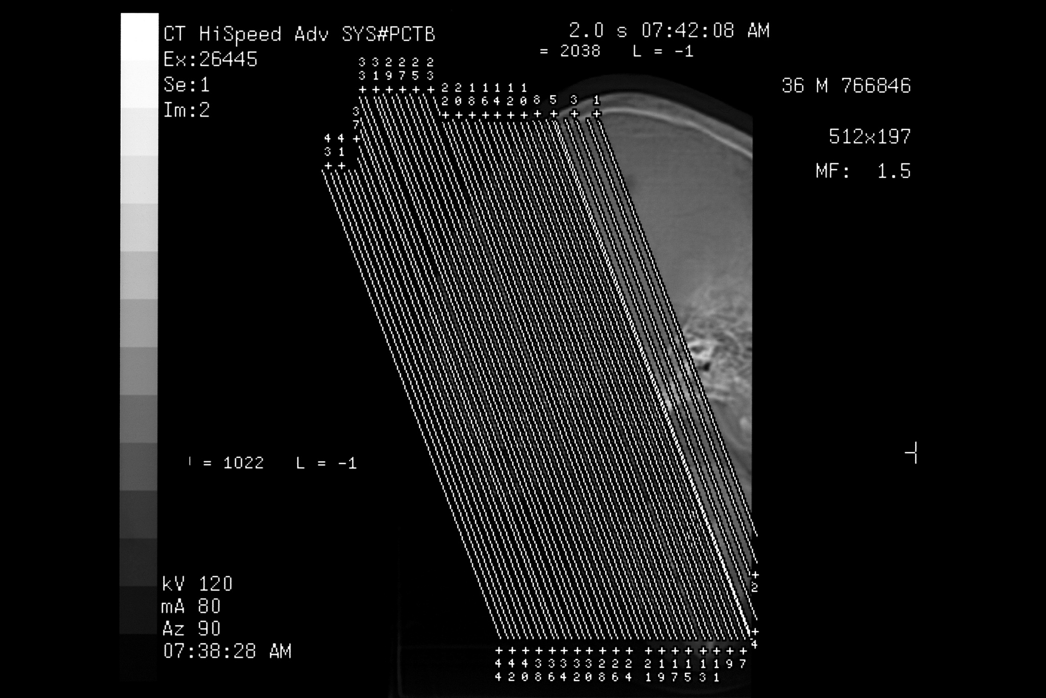 激光焊接小孔多重反射公式及应用