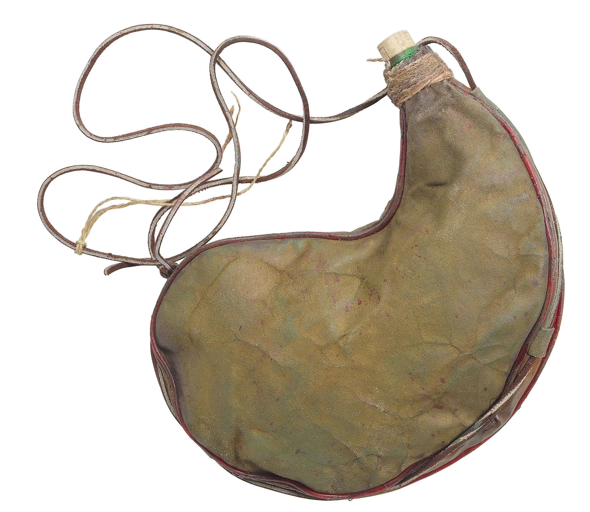 胆囊切除后遗症有哪些？这篇科普告诉你答案！