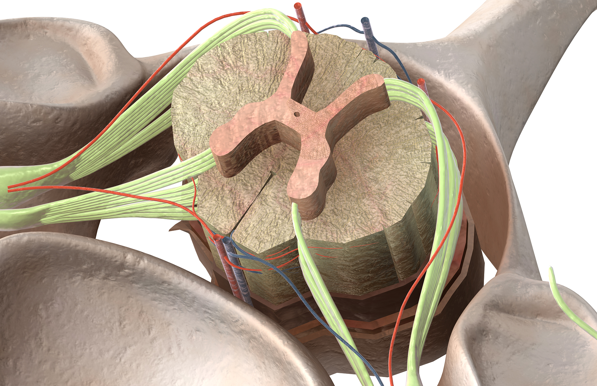 椎管扩大减压+钉棒系统内固定术: 治疗脊柱压迫的有效方法