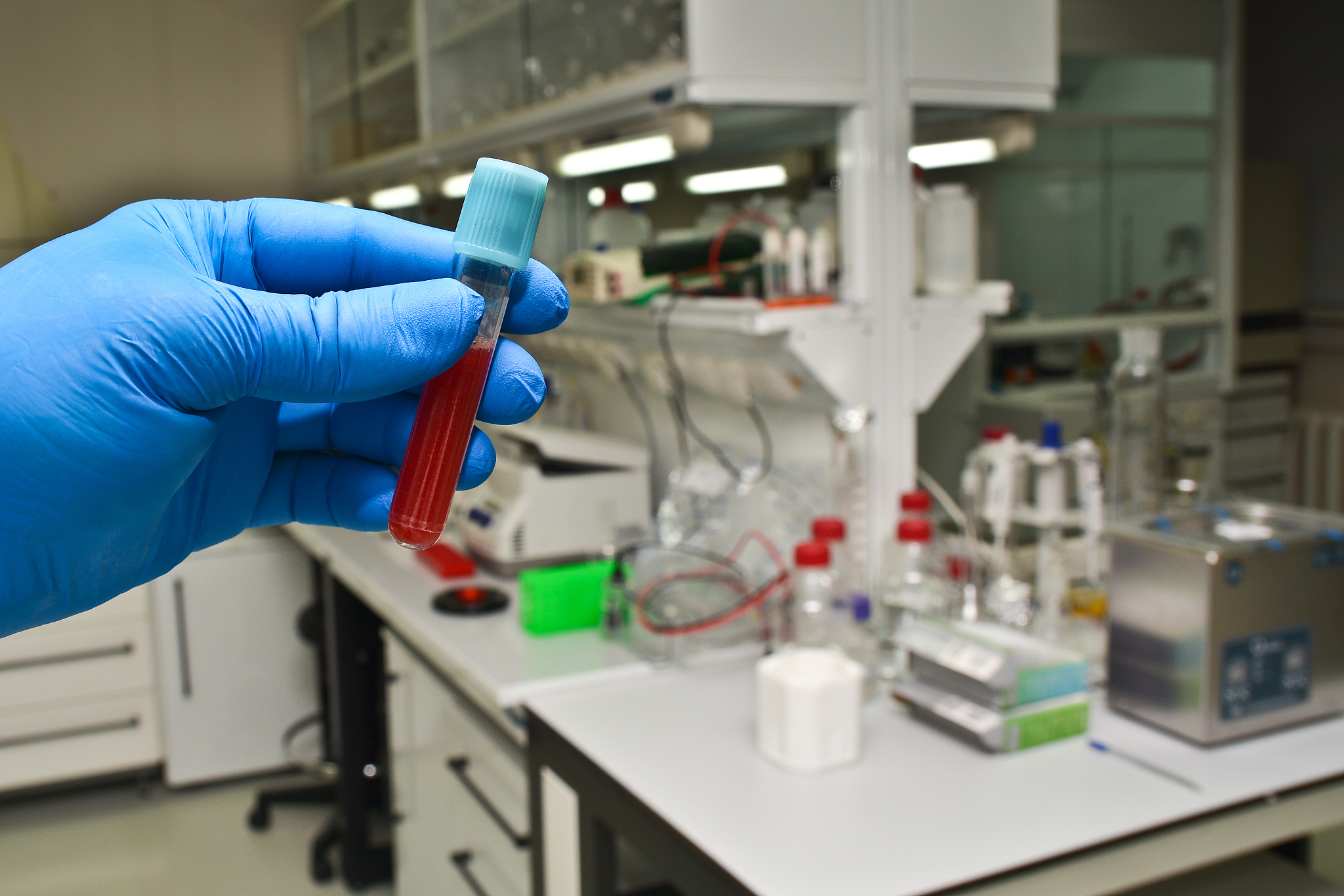 AT2 细胞提取和培养方法：近年来研究趋势