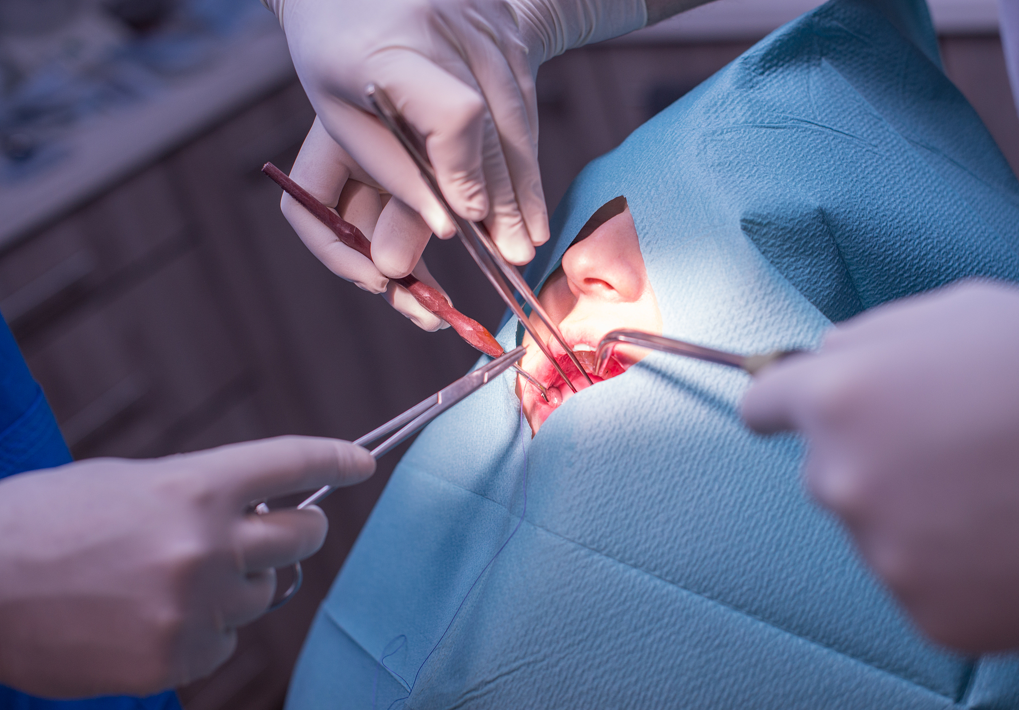 dental surgery