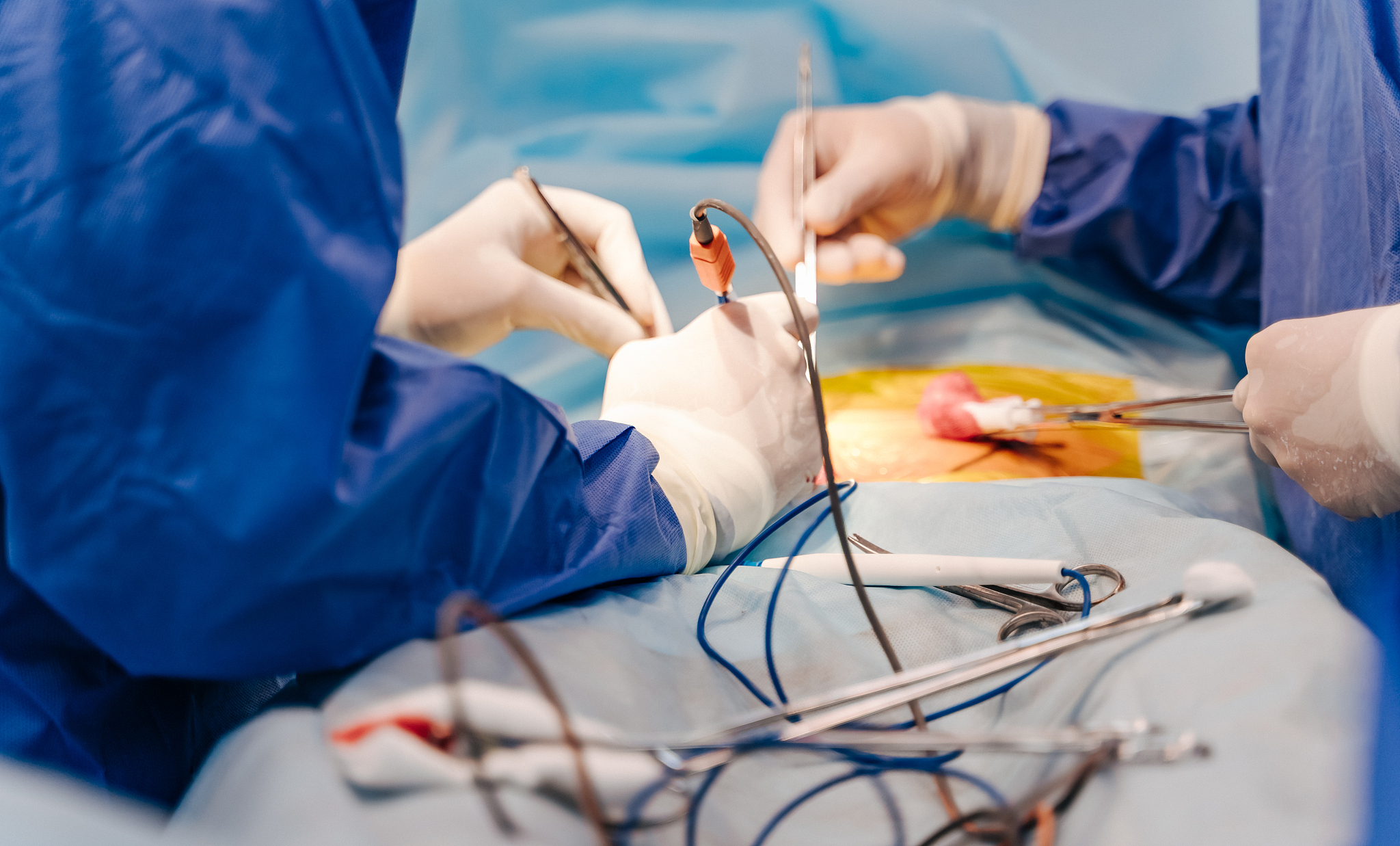 team work with doctors, nurses, surgeons performing surgery on s