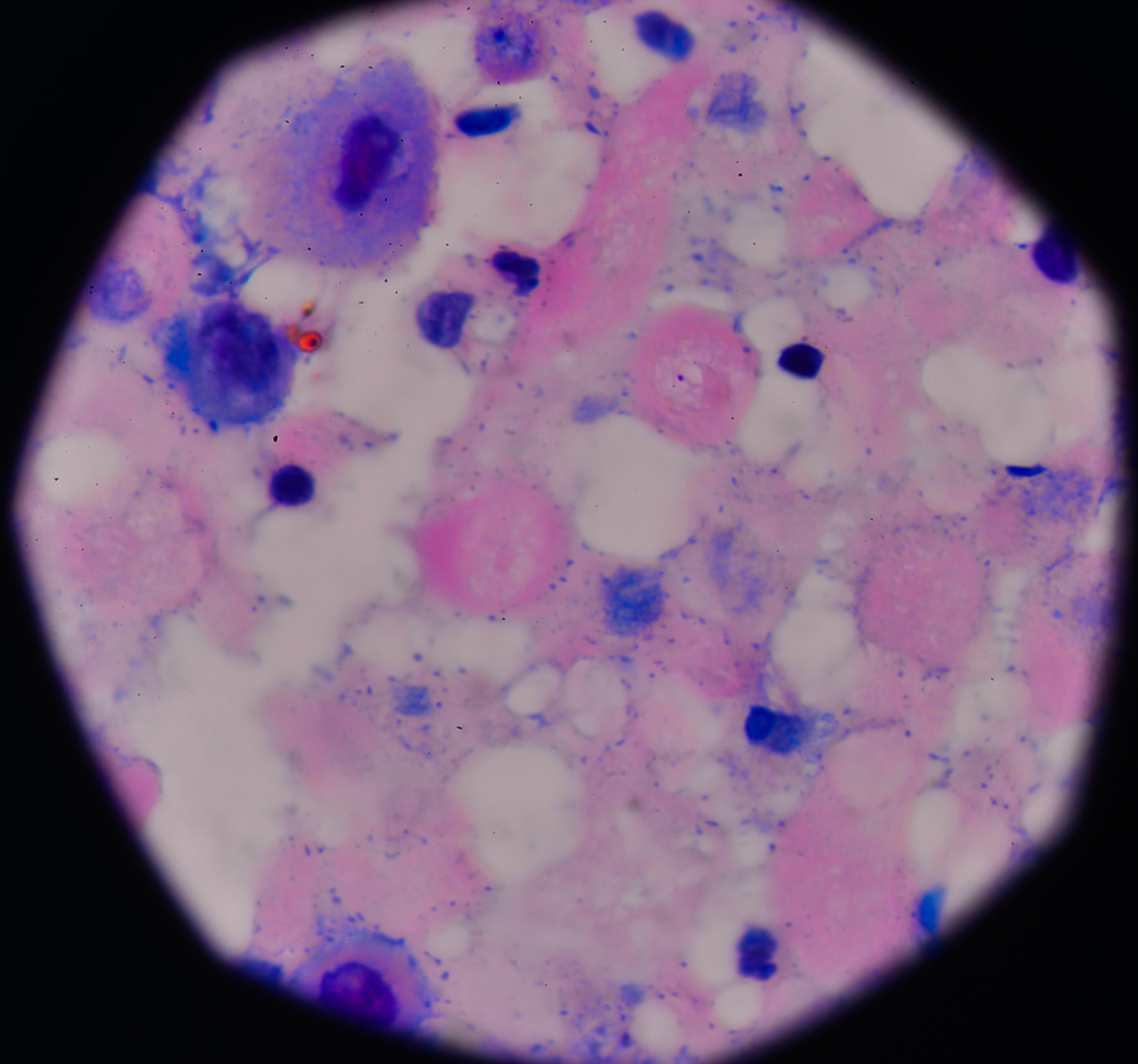 油红O染色法：病理学研究中的利器