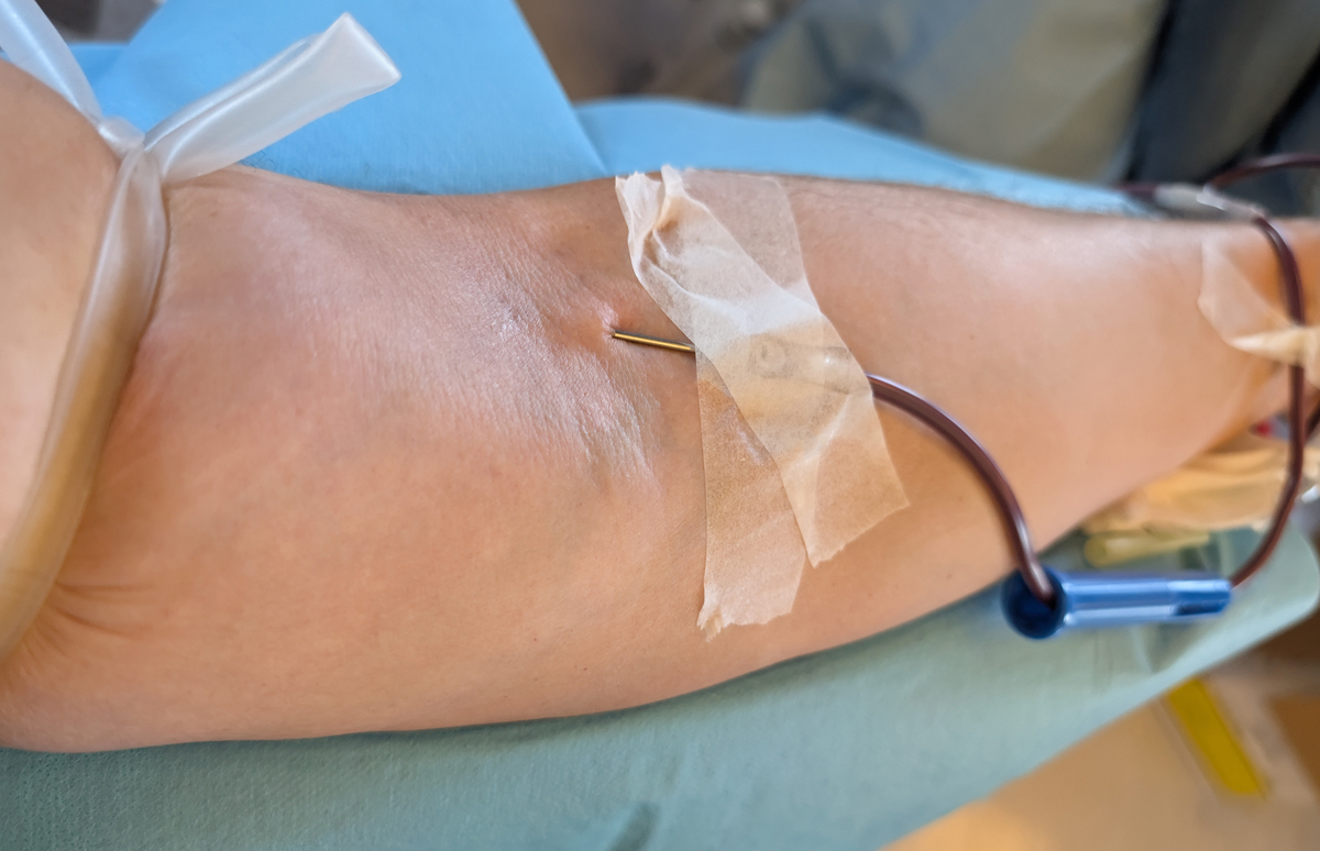 止血带止血法松解频率：多久松解一次？