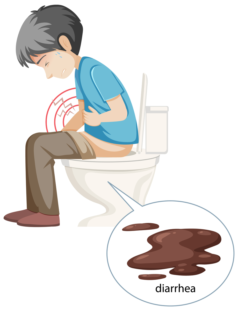 便秘是什么？症状、原因和缓解方法 - 详细介绍