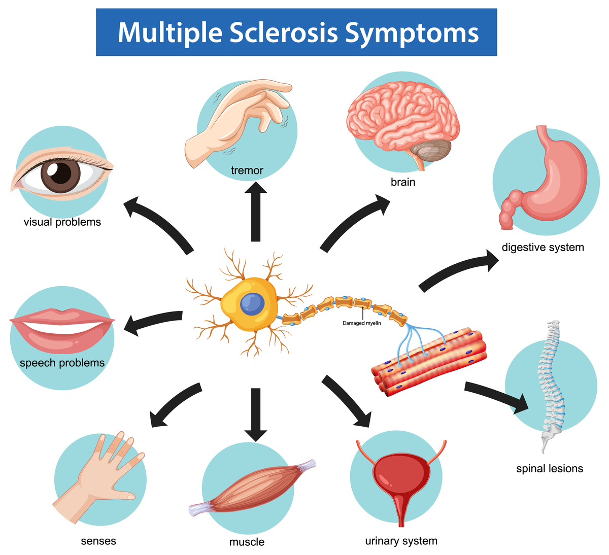 Neurosis: Causes, Effects, and Treatment