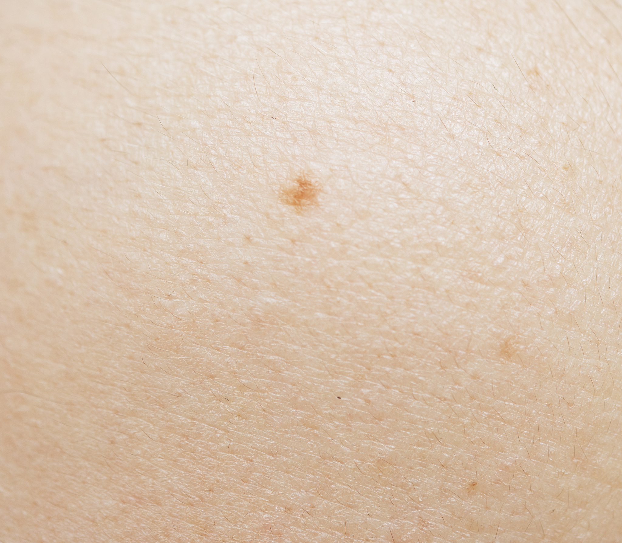 human skin