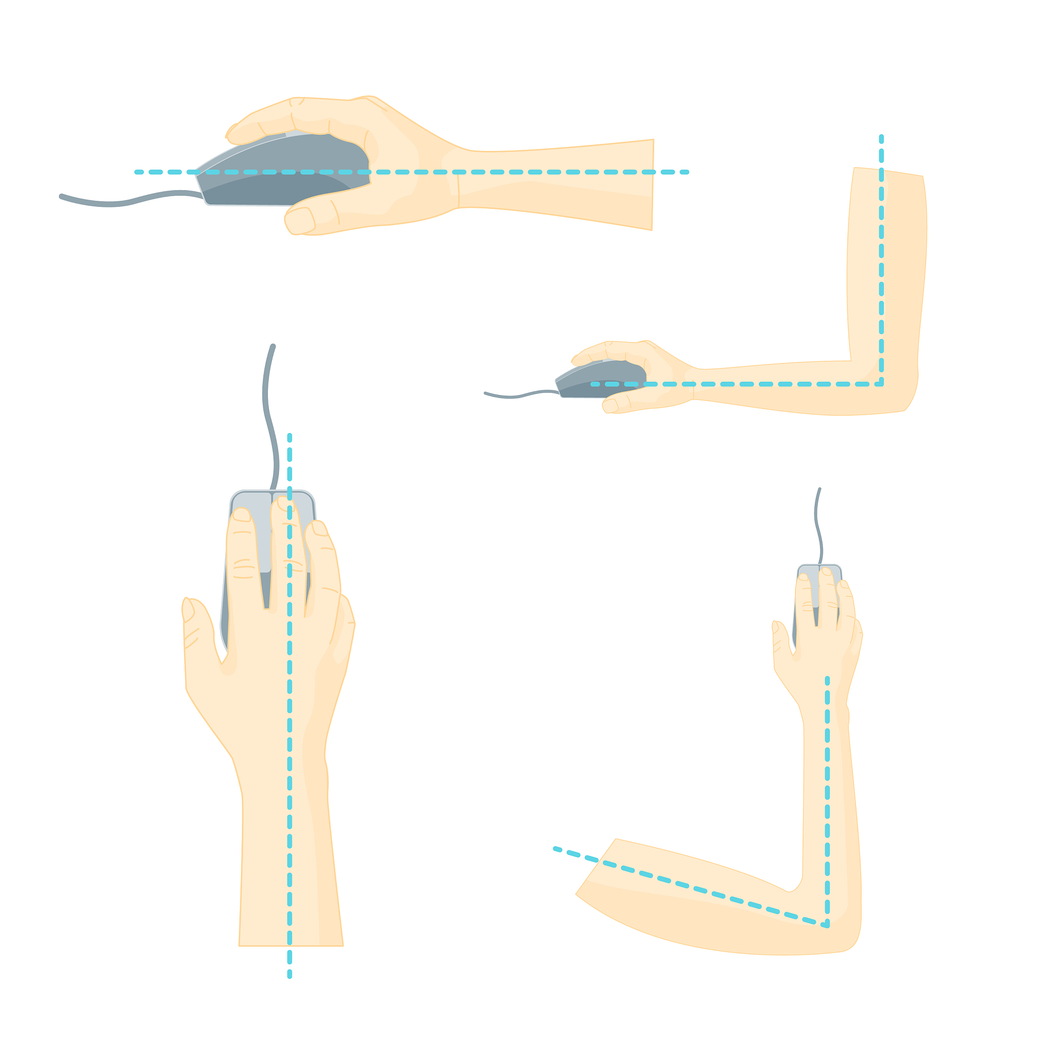 诺和笔注射：正确姿势，水平还是垂直？