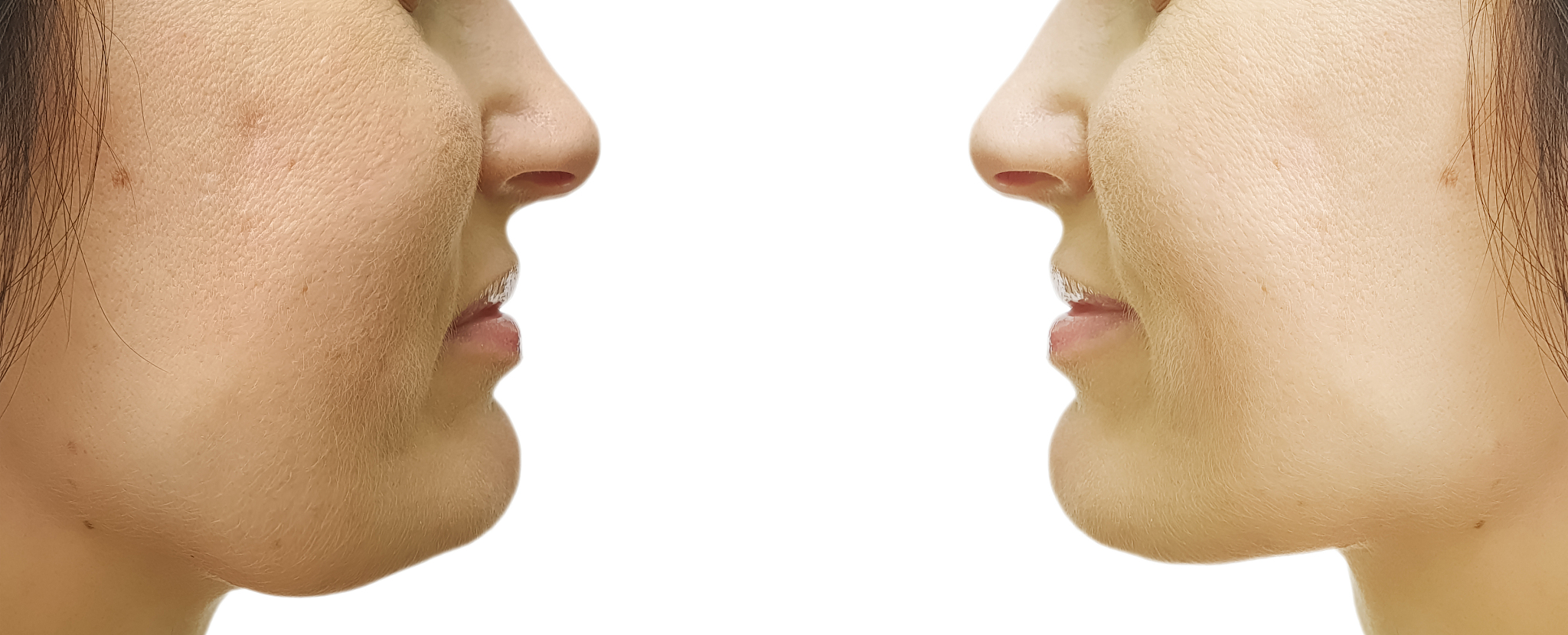 酒窝的秘密：形成原因、遗传和魅力