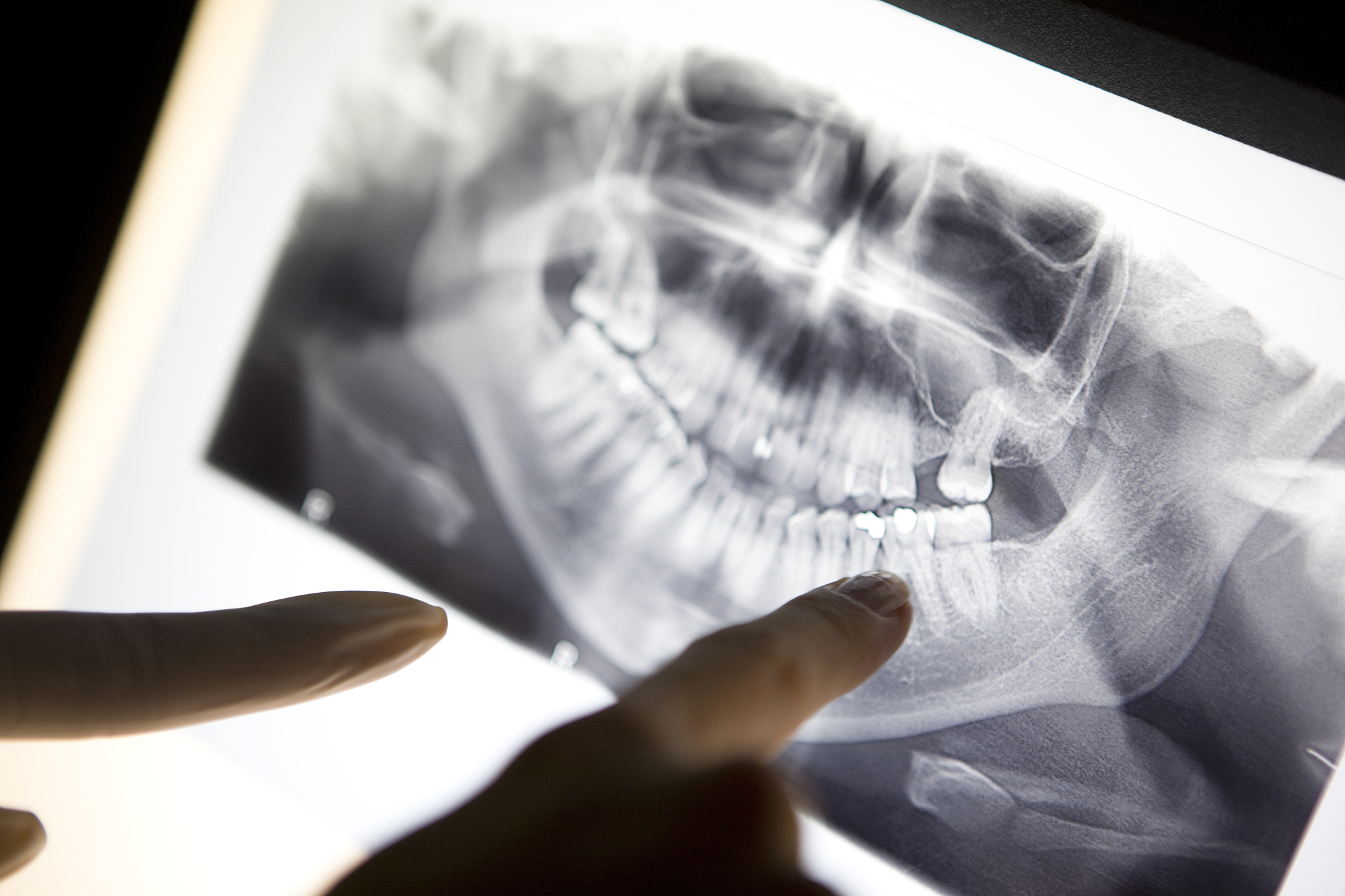 长沙卫生职业学院眼视光技术专业怎么样？优势、不足及就业前景分析