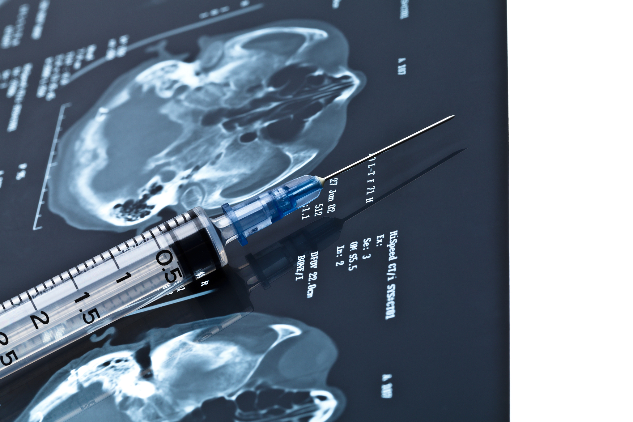 余杭卫生中等专业学校2022年招生专业：护理、医学影像、口腔医学等