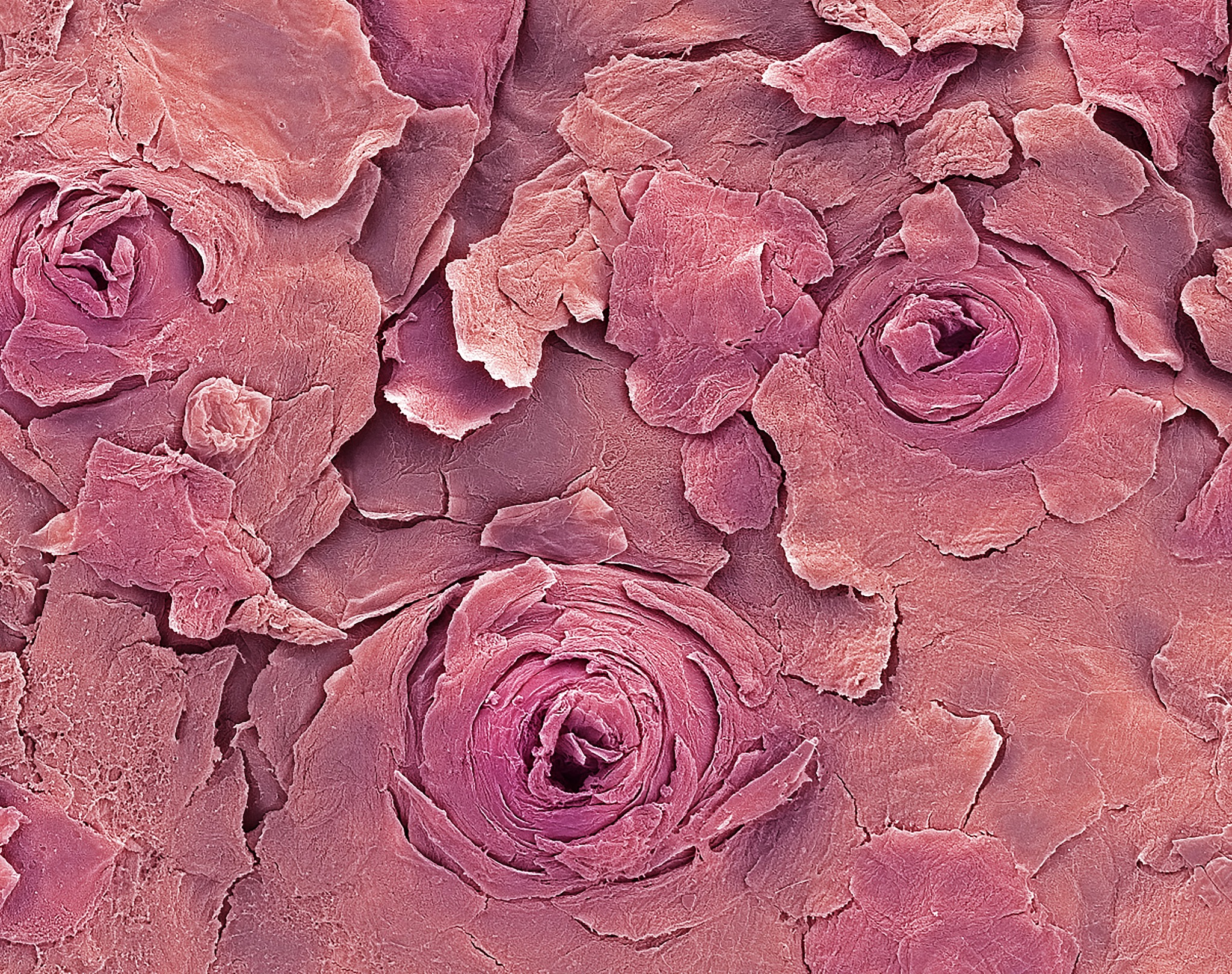 肺的功能：呼吸、气体交换及其他重要作用详解