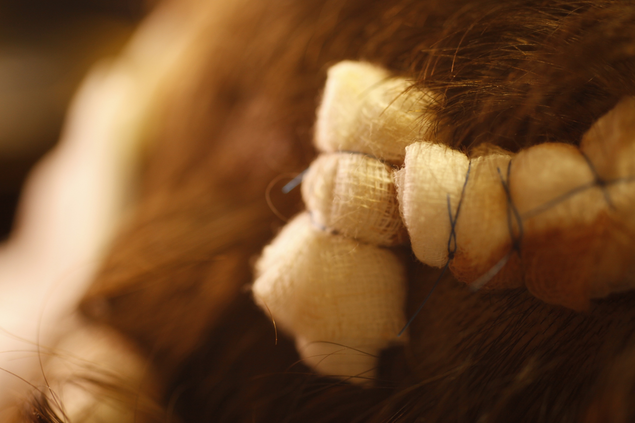 头部轻微撞击会造成伤害吗？