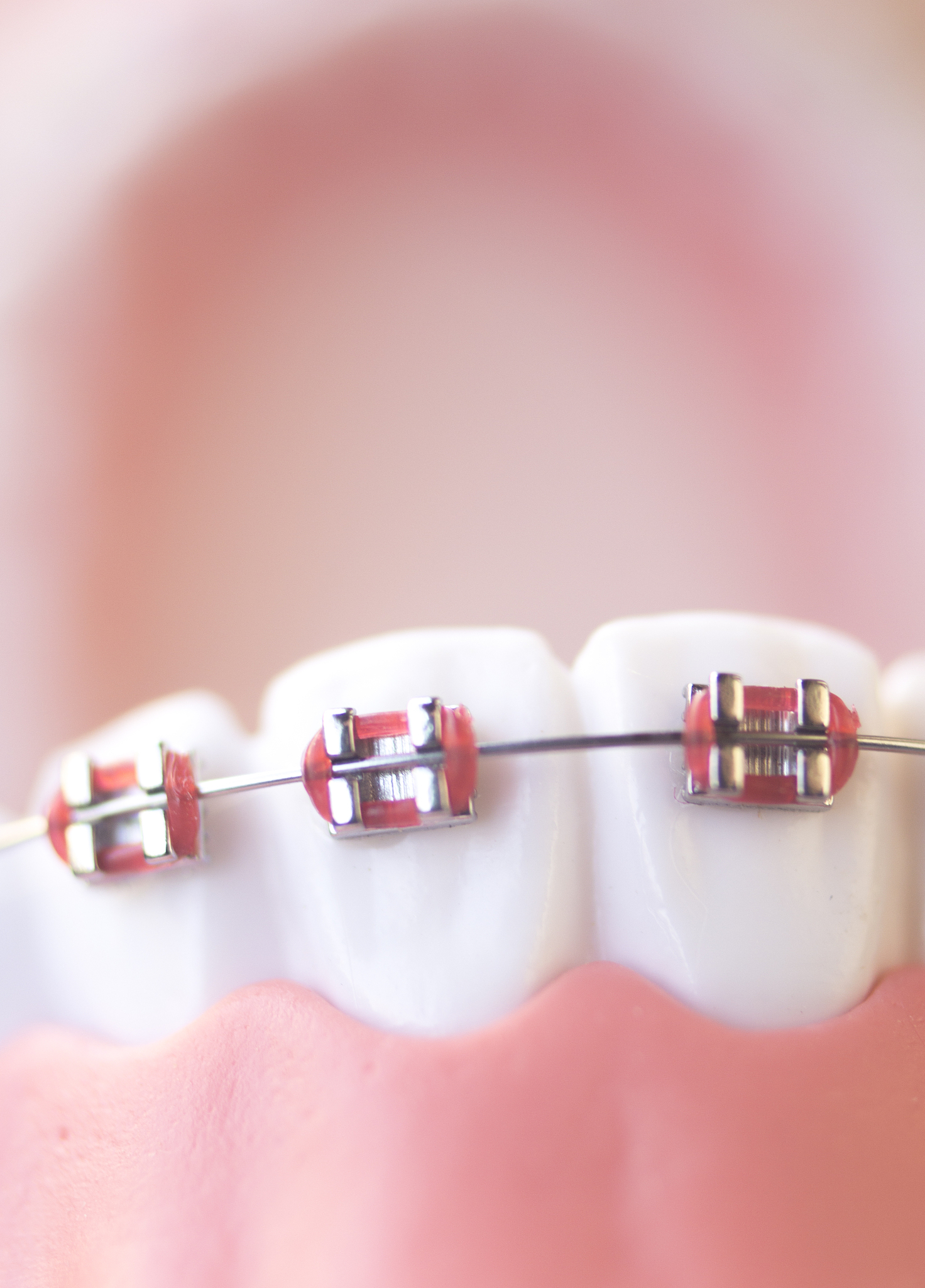 重庆卫校口腔医学技术毕业好找工作吗？就业前景分析