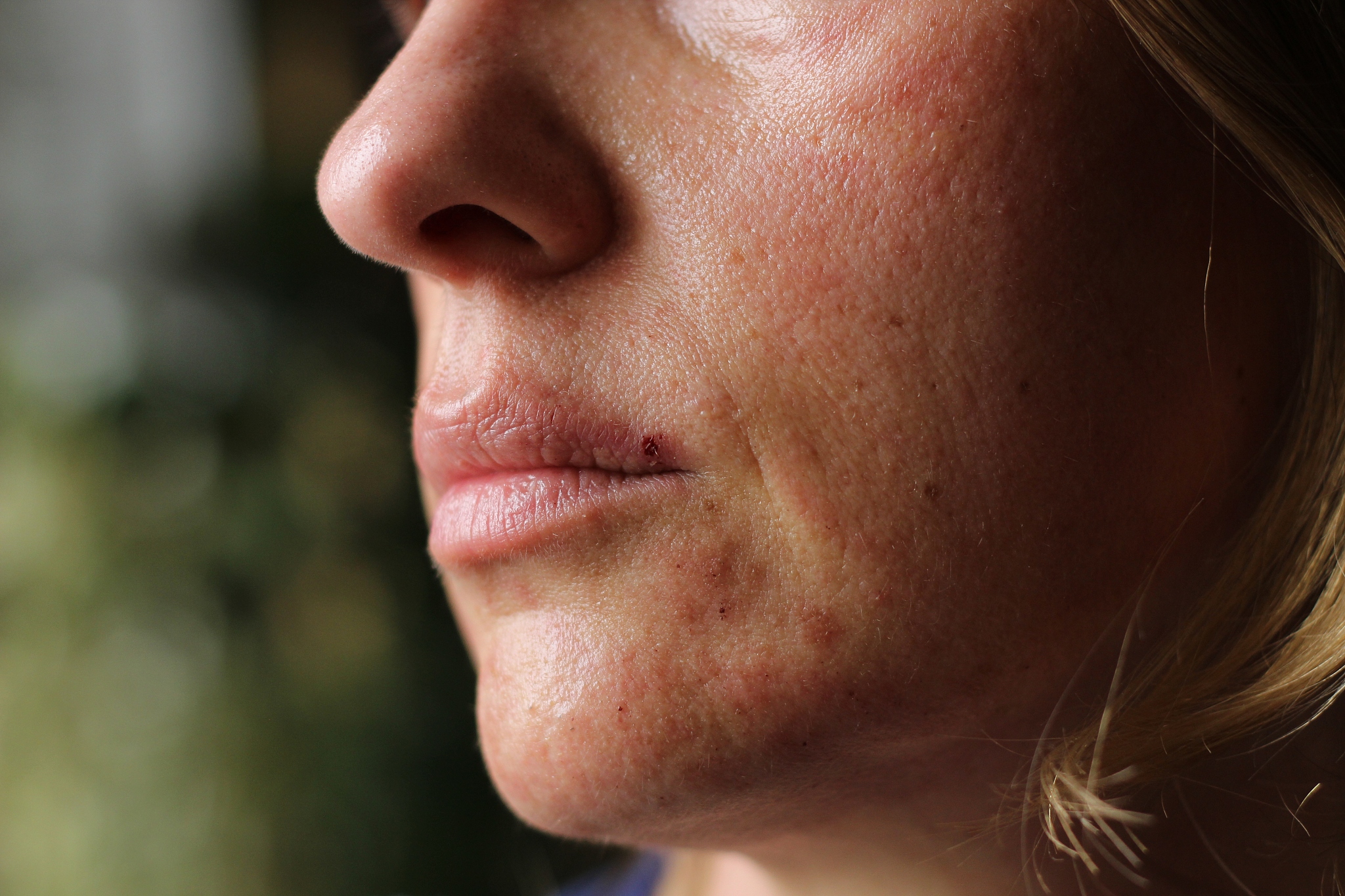 woman face after facial treatment