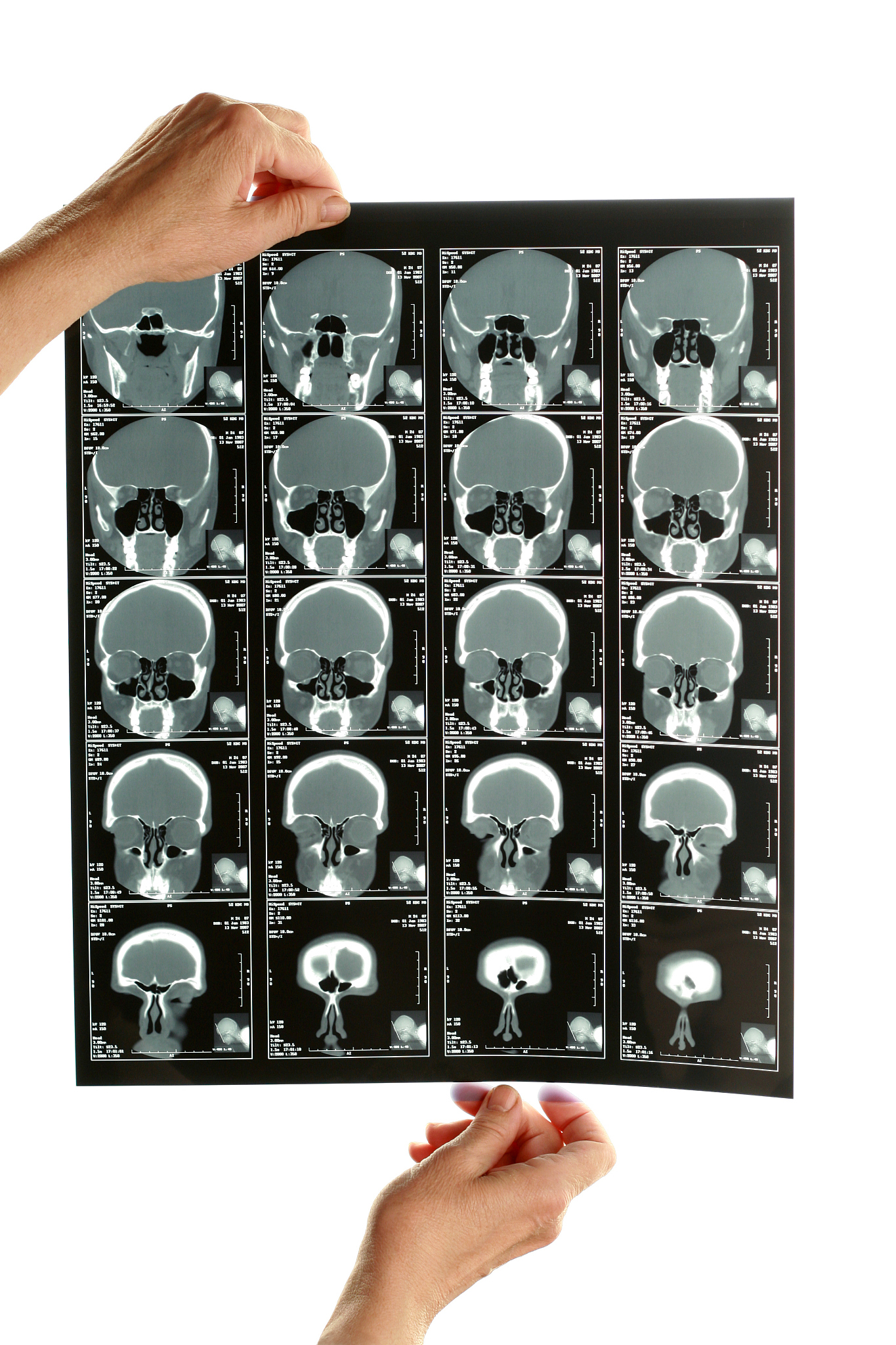 计算机断层扫描图像反映了通过不同灰度级扫描的绵羊不同组织的信息。