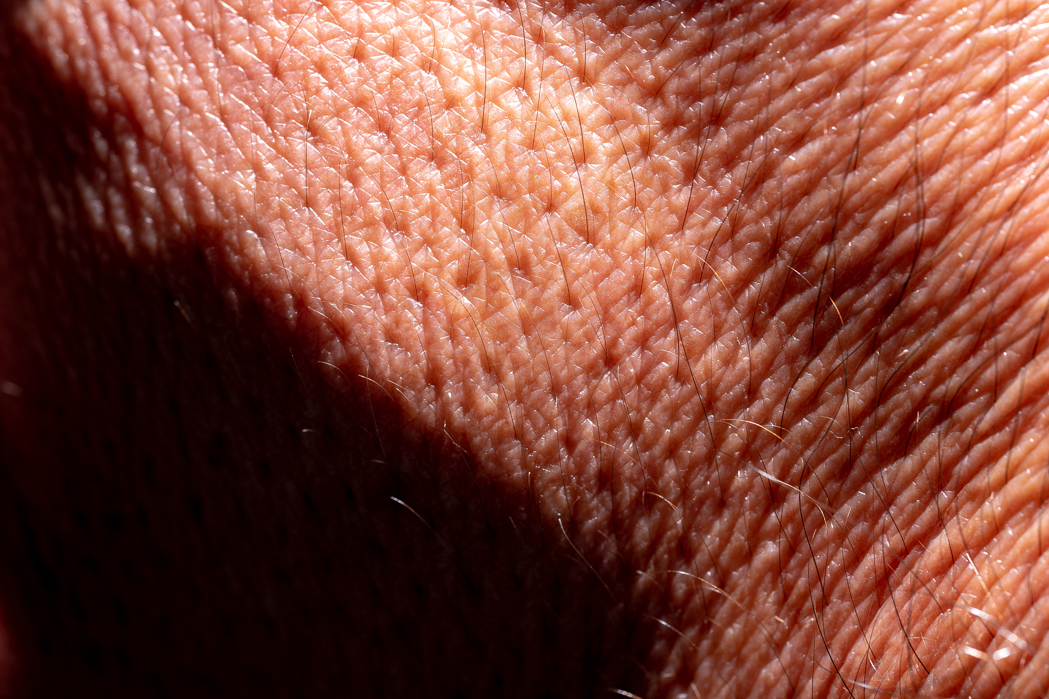 skin of a human hand where hair can be seen.