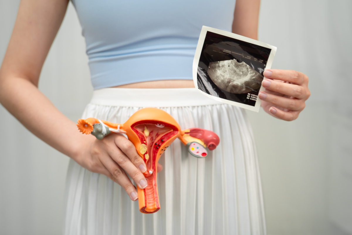 盆腔积液怎么回事