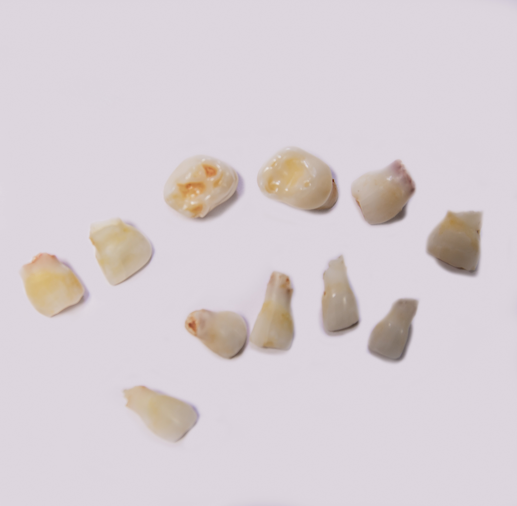 根管水泥是啥？