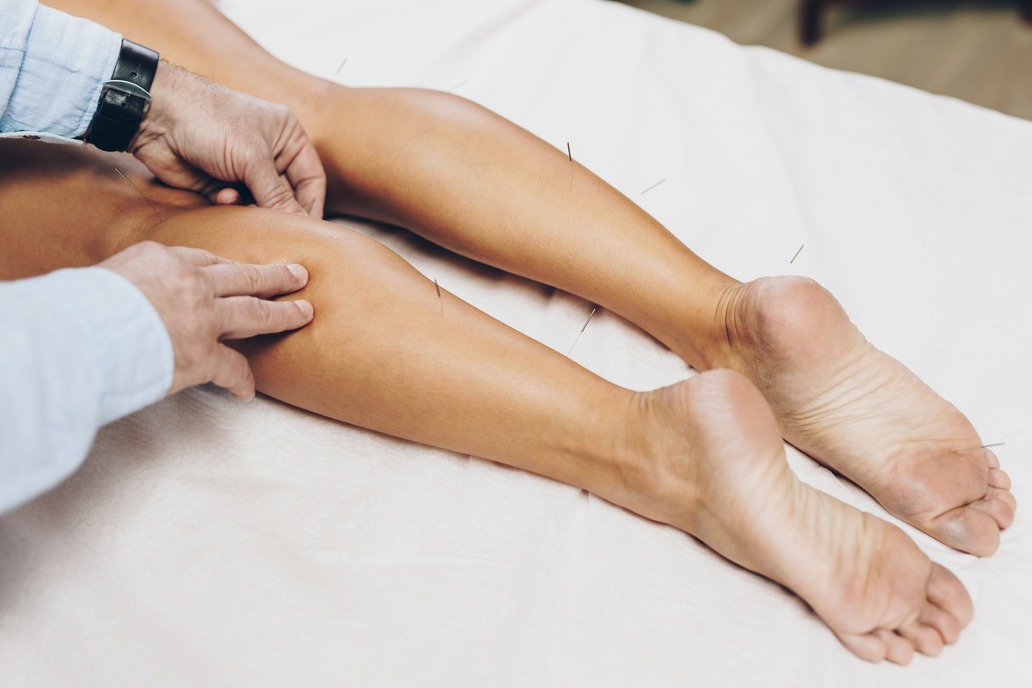acupuncture and massage treatment