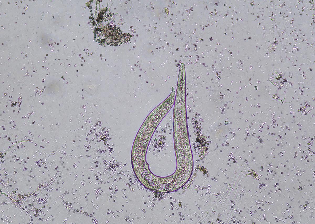 讲述小明外出旅游为考验自己肠胃功能和肠胃免疫力喝不太干净发臭的河水感染贾第鞭毛虫继续喝三天河水拉肚子三天三夜越来越严重的具体经历。描绘拉肚子的痛苦感受等情况。