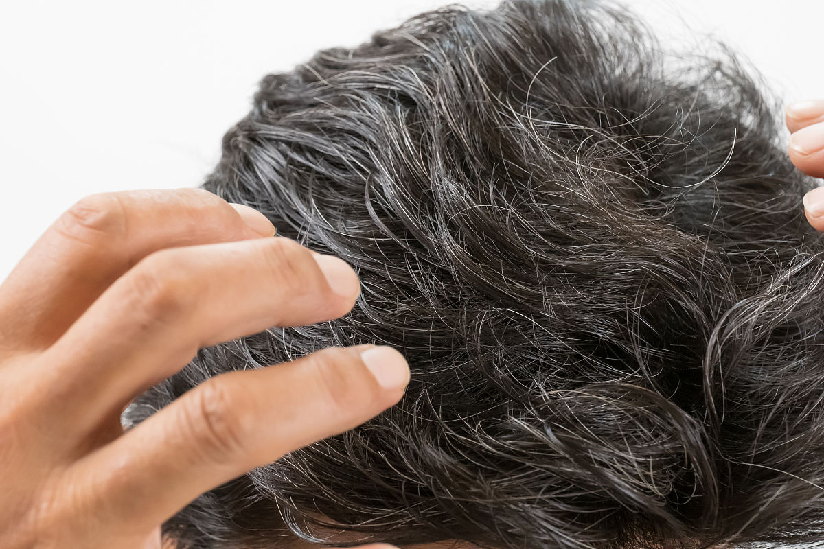 摆脱白发烦恼！恢复年轻发色，重拾自信