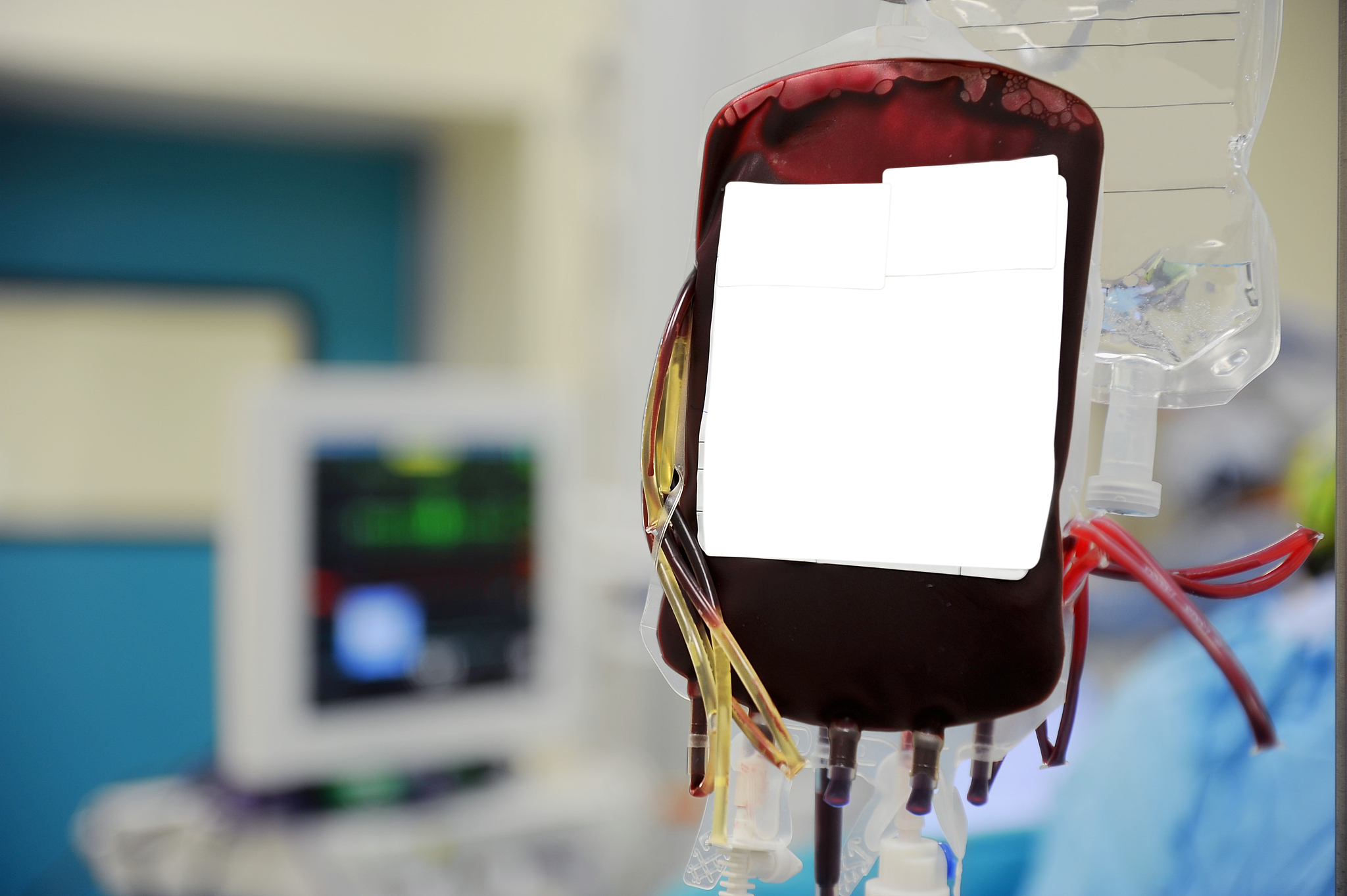 心脏膜瓣病手术治疗患者的术前准备