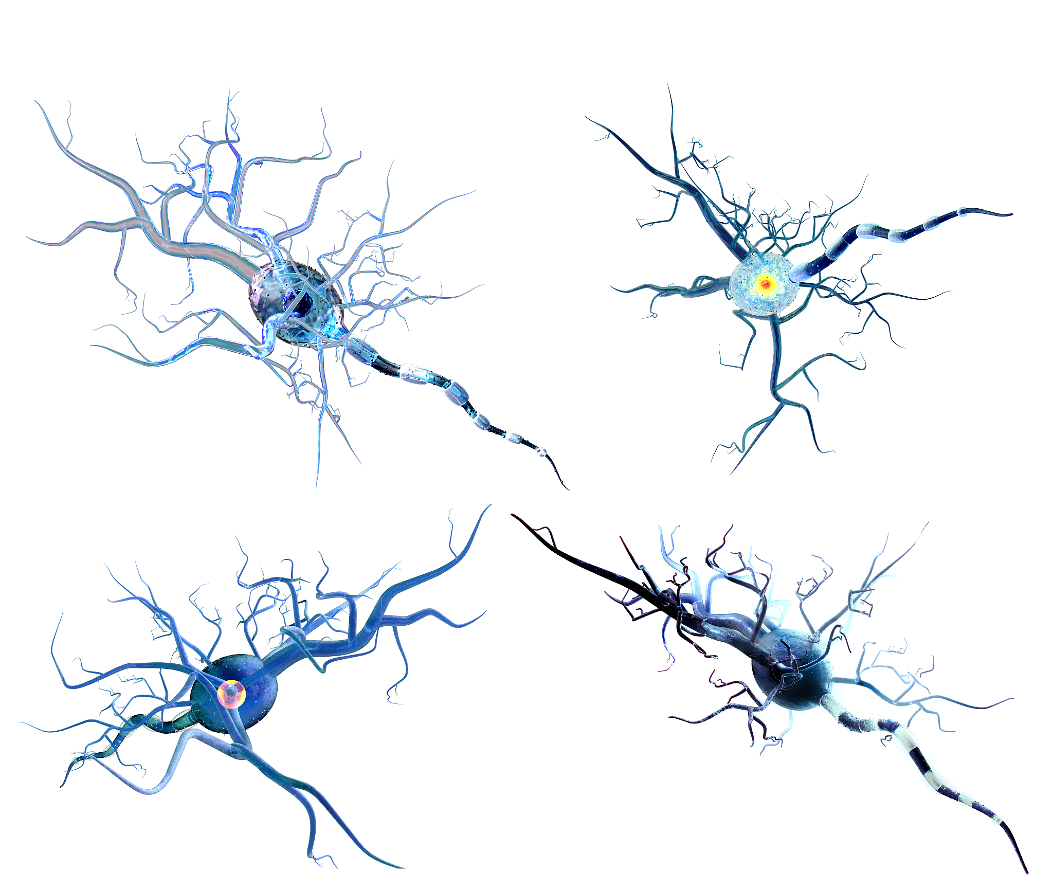 放射性神经损伤的研究文章有哪些？