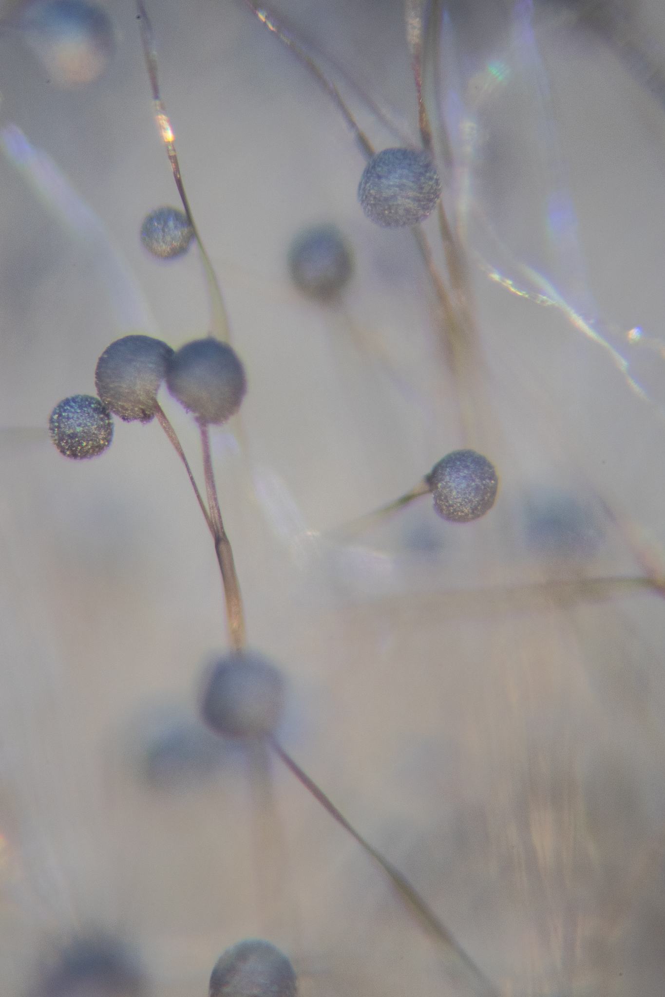 霉菌显微镜观察结果：青霉、曲霉、黑根霉等7种霉菌形态分析