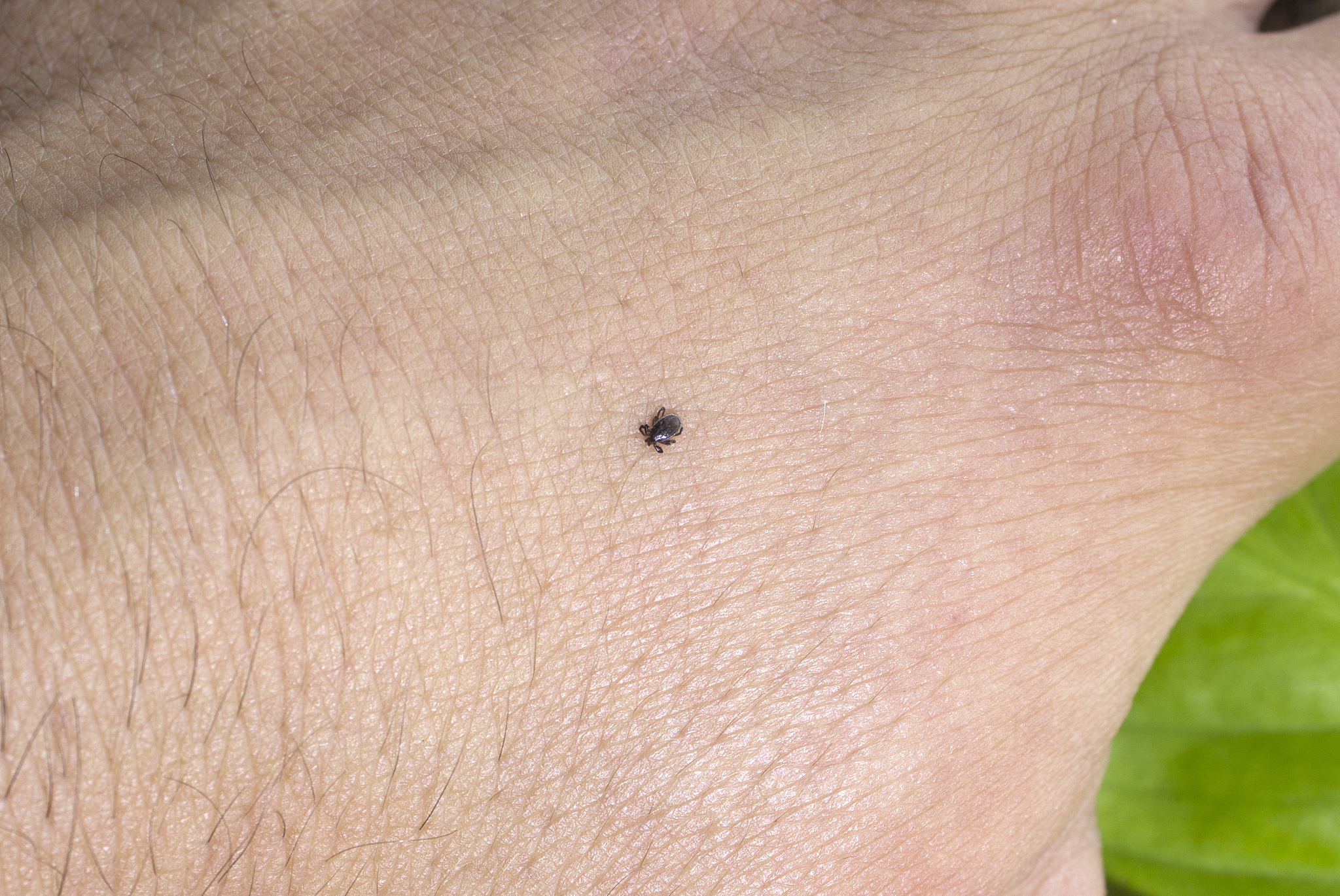 small mite, on the man's arm, close up