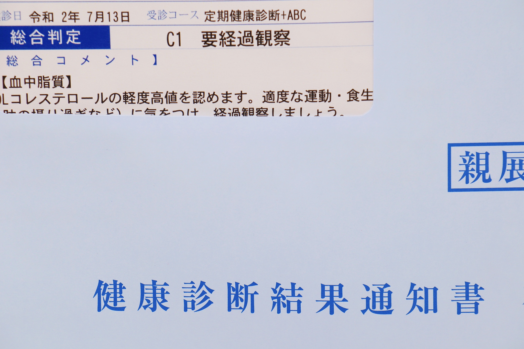 普通话语音错误形成原因分析：母语影响、模仿不准等