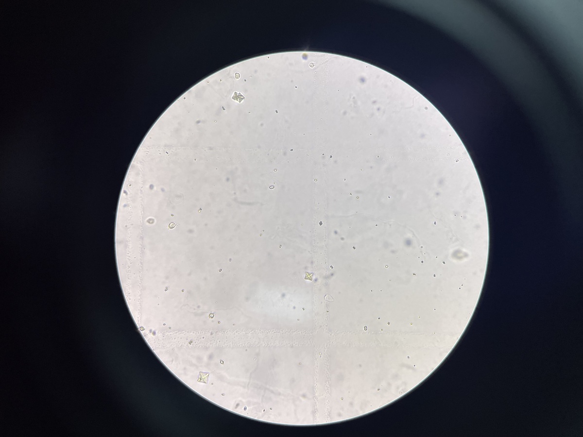 晚睡晚起晶体的晶体学分析方法