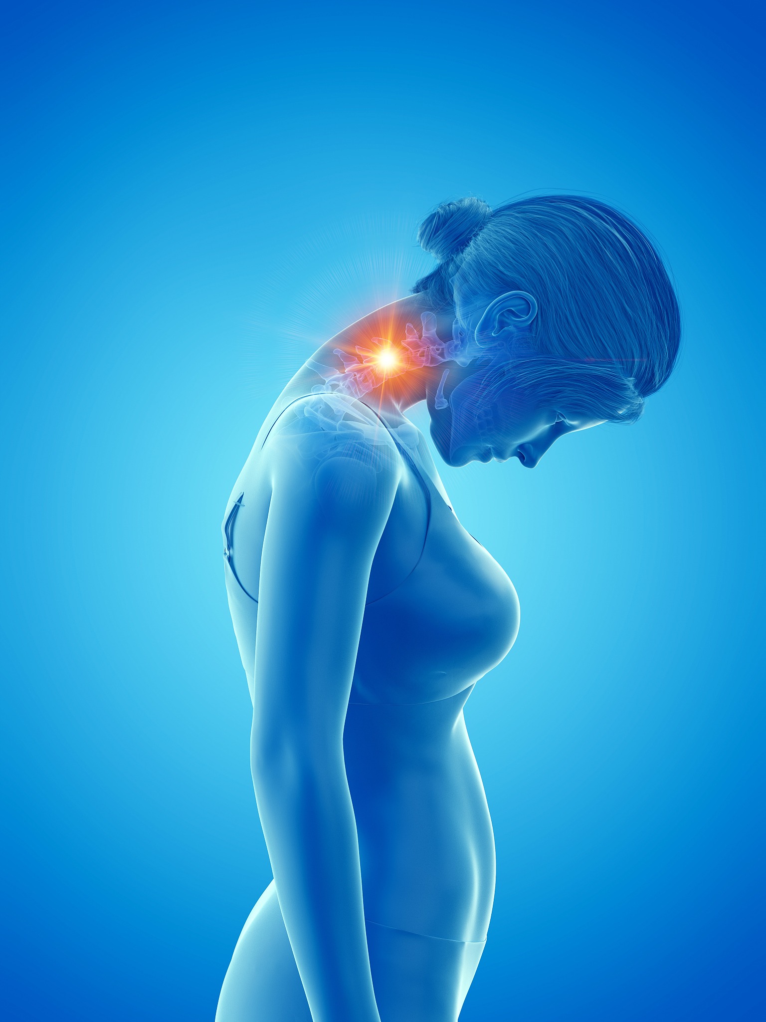 woman with a painful neck, illustration