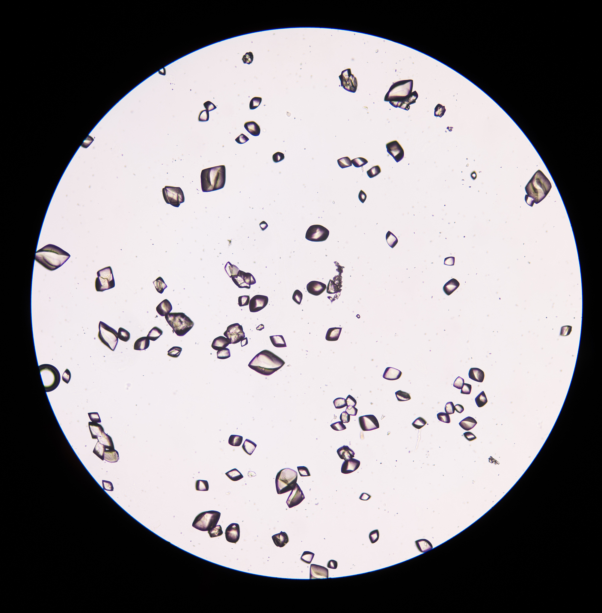 尿胆红素升高的原因：饮食、药物、疾病等因素