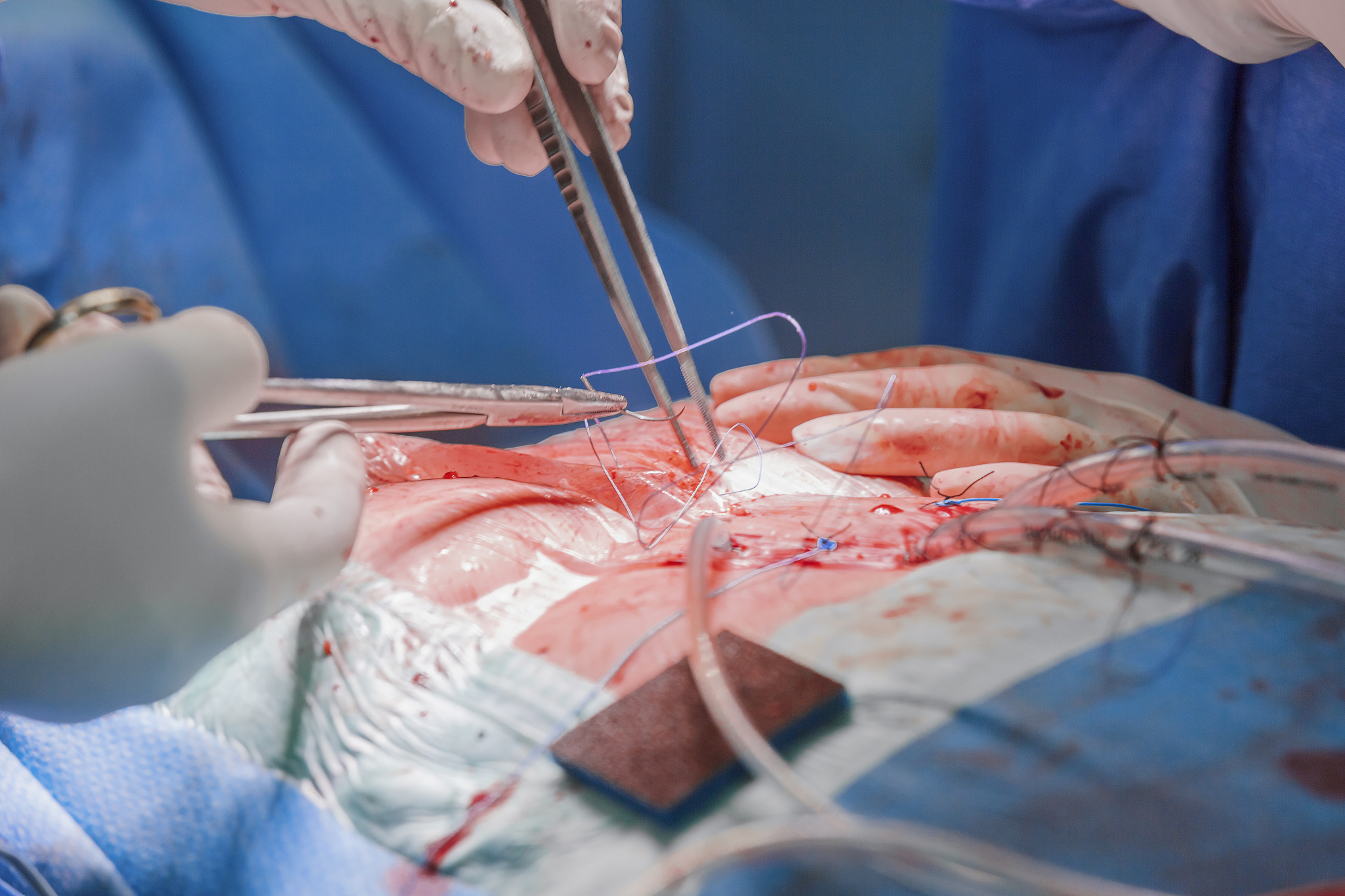 surgical operation - close-up