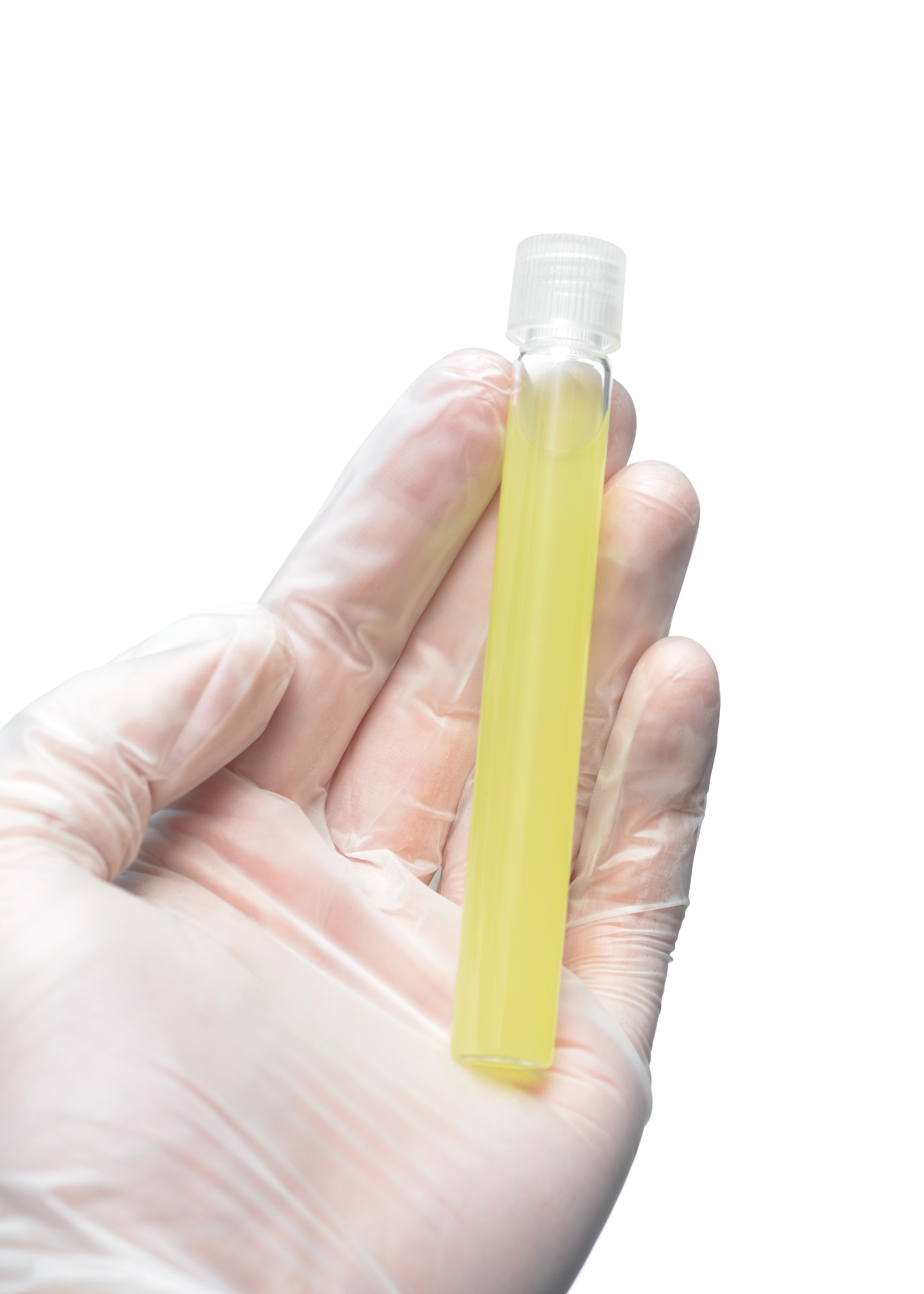 尿检UC00mmoll是什么意思